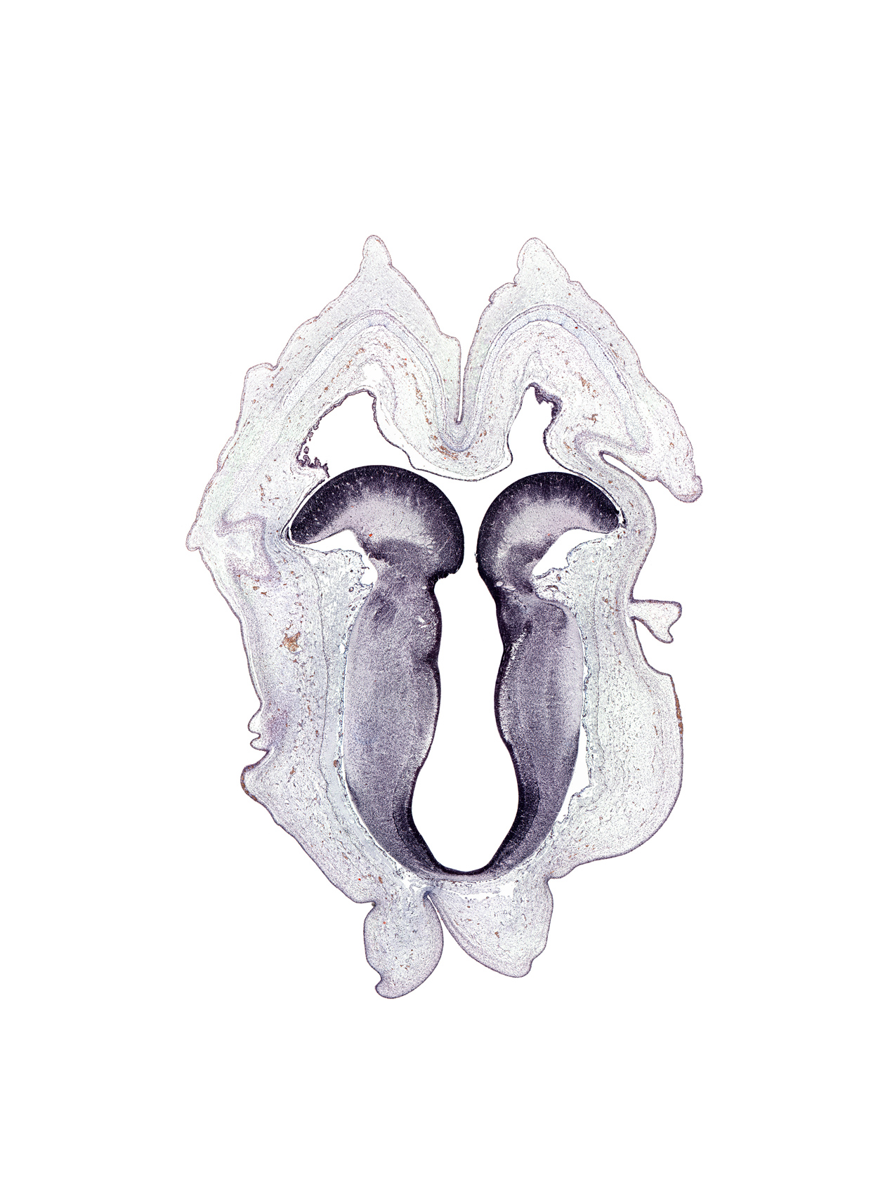 basal plate of mesencephalon, head mesenchyme, osteogenic layer, sulcus limitans, surface ectoderm, trochlear nerve tract, vascular plexus, vestibular area