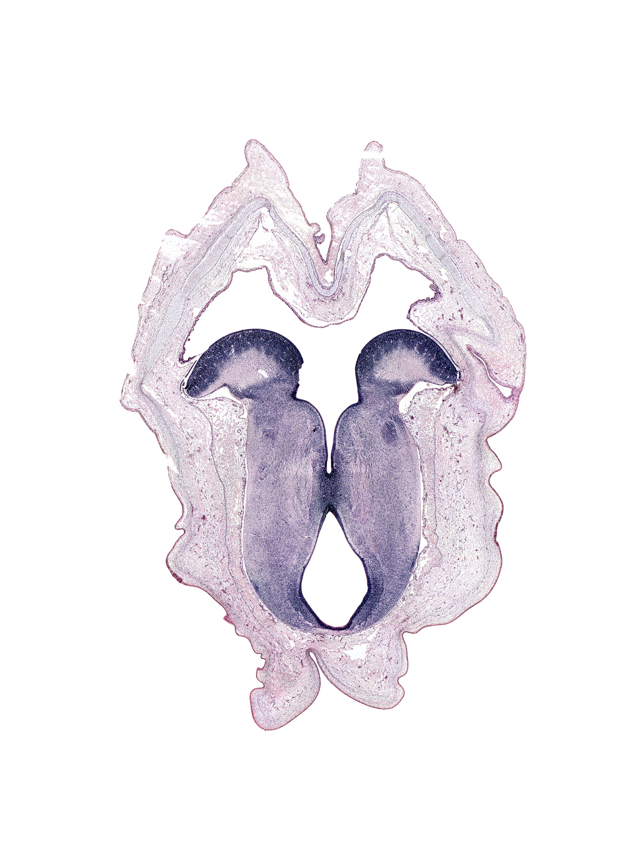 cerebral aqueduct (mesocoele), hand ray condensation, isthmic canal, motor nucleus of facial nerve, oculomotor nerve tract, rhombencoel (fourth ventricle), vestibular area