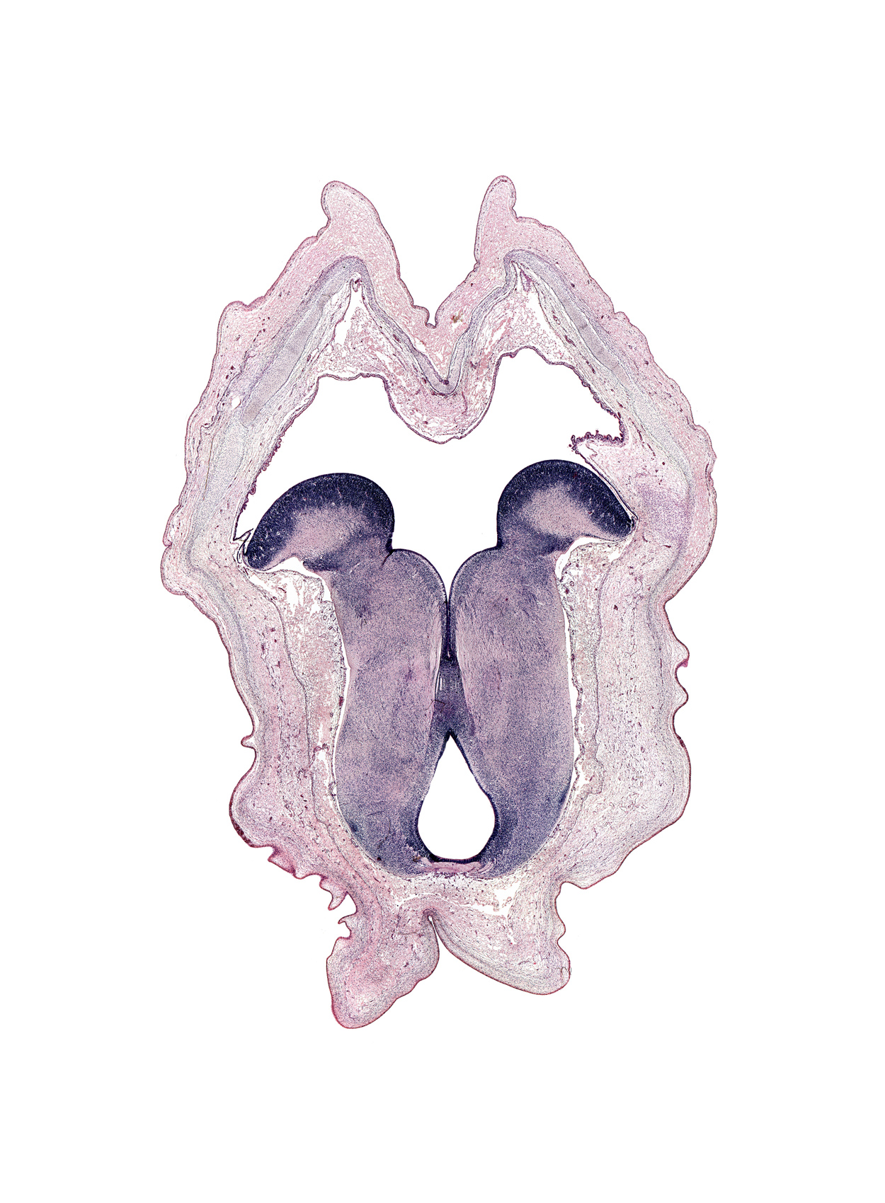 caudal part of diencephalon, facial nerve tract, junction of cerebral aqueduct and third ventricle, medial longitudinal fasciculus, posterior commissure, red nucleus, rhombencoel (fourth ventricle), vestibular area