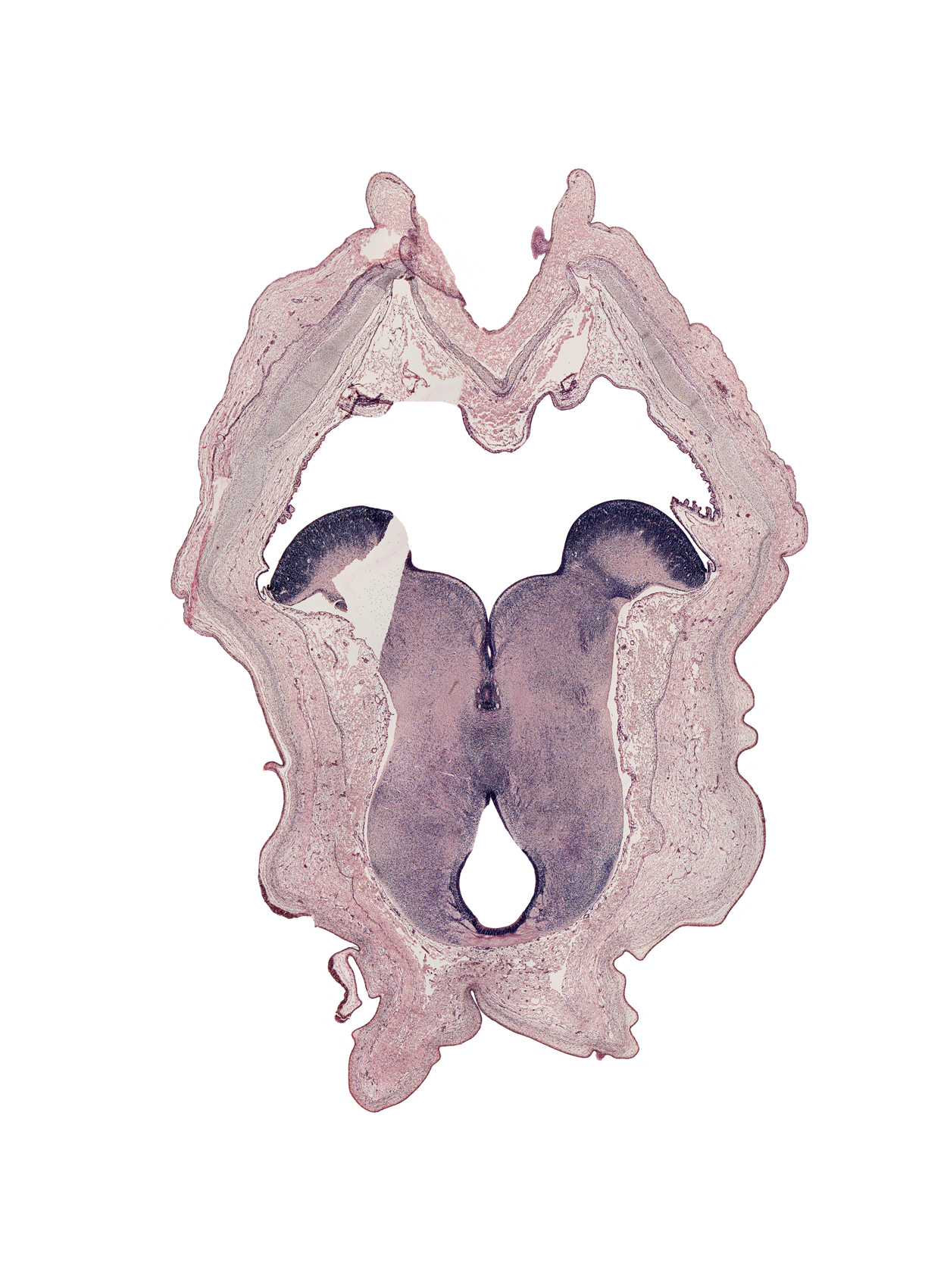 alar plate of metencephalon (cerebellum), artifact separation(s), caudal part of third ventricle, interpeduncular nucleus, oculomotor nerve tract, posterior commissure (diencephalon), red nucleus, rhombencoel (fourth ventricle), roof plate, tegmentum of mesencephalon, tegmentum of metencephalon