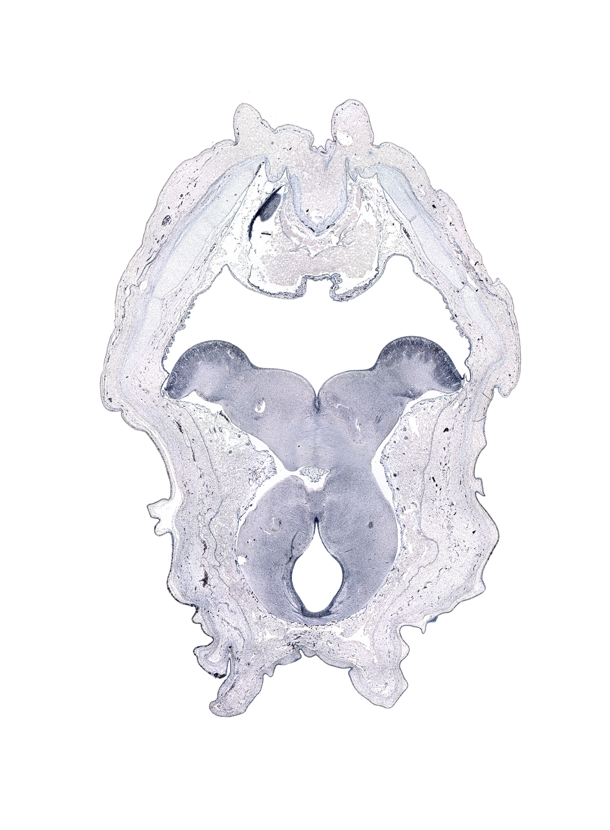 artifact(s), caudal part of third ventricle, cerebral peduncle, edge of myelencephalon, exoccipital, external cerebellum, internal cerebellum, interpeduncular fossa, posterior commissure, rhombencoel (fourth ventricle), sulcus limitans