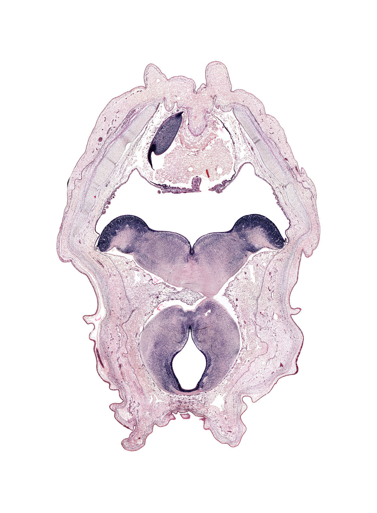 abducens nucleus, alar plate of myelencephalon, basis pedunculi of pons region (metencephalon), caudal part of diencephalon, facial colliculus, facial nerve tract, interpeduncular fossa, oculomotor nerve tract, posterior commissure, rhombencoel (fourth ventricle), roof plate, sulcus limitans, tegmentum of mesencephalon