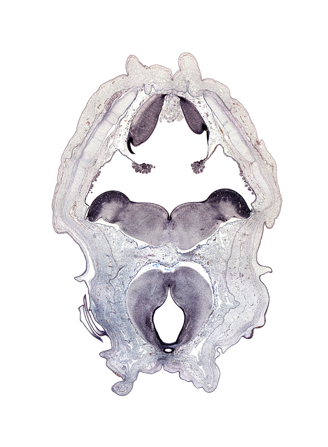 alar plate of myelencephalon, artifact space(s), cerebral peduncle, choroid plexus, diencephalon, facial nerve genu, interpeduncular fossa, myelencephalon (medulla oblongata), oculomotor nerve tract, pineal recess, rhombencoel (fourth ventricle), roof plate, roof plate of metencephalon, tegmentum of mesencephalon