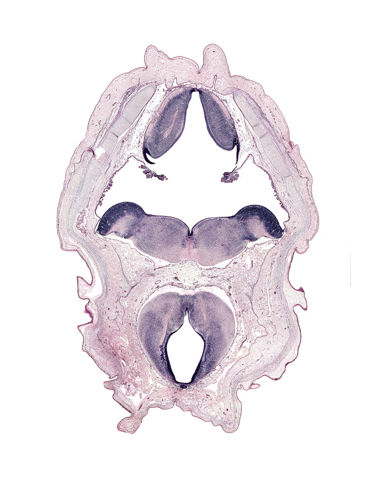 alar plate of myelencephalon, artifact space(s), choroid plexus, dura mater, dural venous plexus, epiphysis, exoccipital, facial nerve tract, head mesenchyme, median sulcus, oculomotor nerve tract, posterior cerebral artery, rhombencoel (fourth ventricle), roof plate of myelencephalon, root of oculomotor nerve (CN III), subarachnoid space, sulcus limitans, surface ectoderm, tegmentum