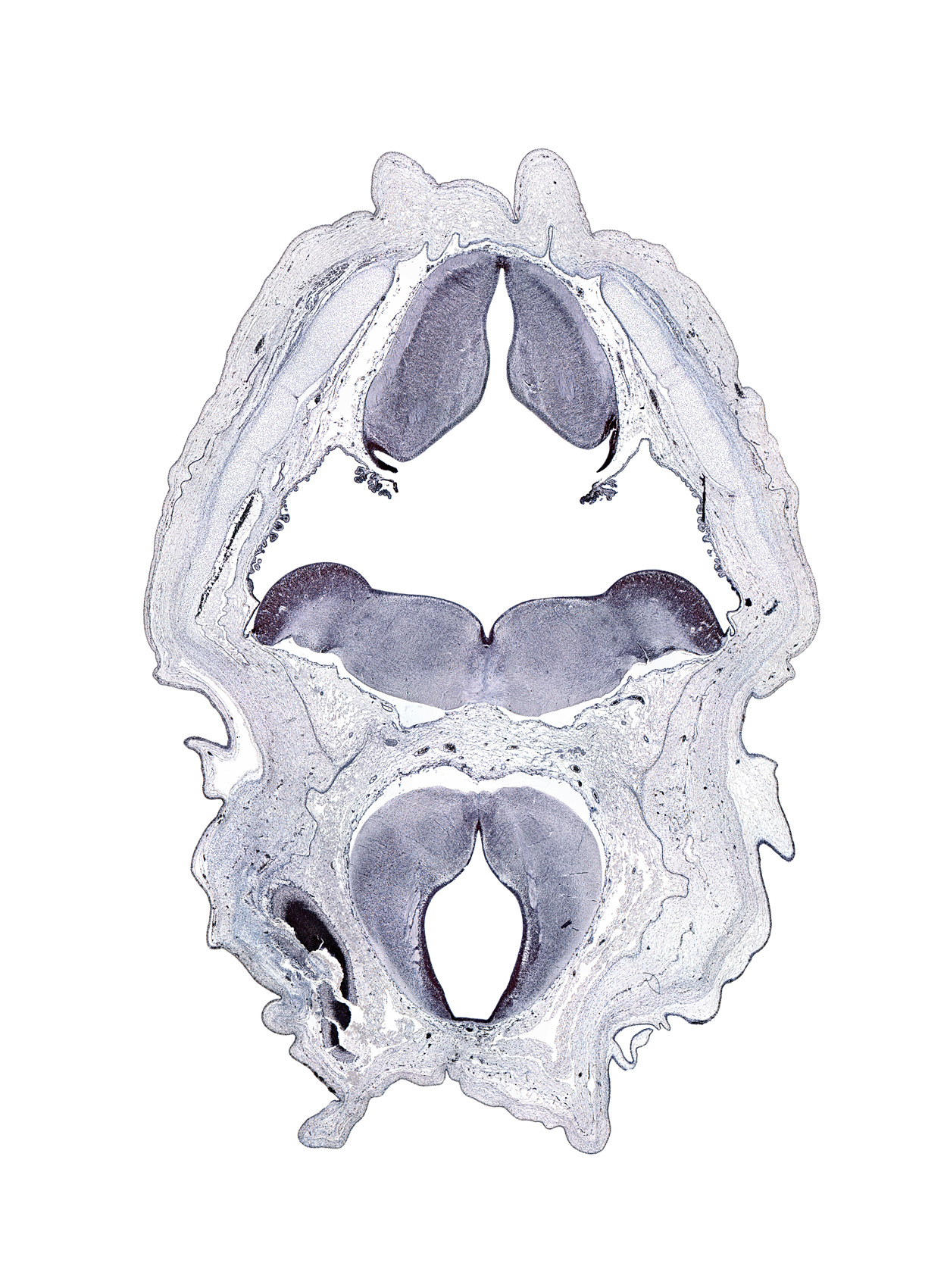 abducens nucleus, artifact space(s), basal plate, edge of cerebral vesicle (hemisphere), facial nerve tract, hypoglossal nucleus, myelencephalon (medulla oblongata), rhombencoel (fourth ventricle), sulcus limitans, third ventricle, tractus solitarius