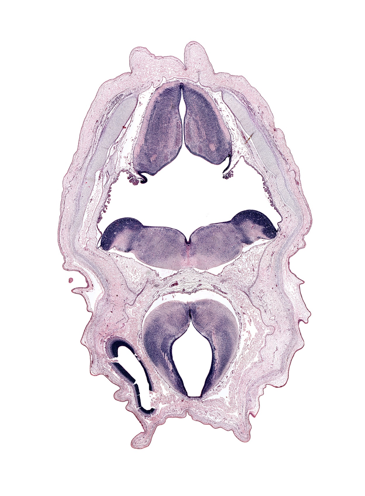 alar plate of metencephalon (cerebellum), artifact space(s), cerebral vesicle (hemisphere), cochlear nucleus area, diencephalon, fiber tract, hypoglossal nucleus, median sulcus, obex, pons region (metencephalon), posterior cerebral artery, rhombencoel (fourth ventricle), subarachnoid space, sulcus limitans, tegmentum of mesencephalon, tegmentum of metencephalon, tractus solitarius