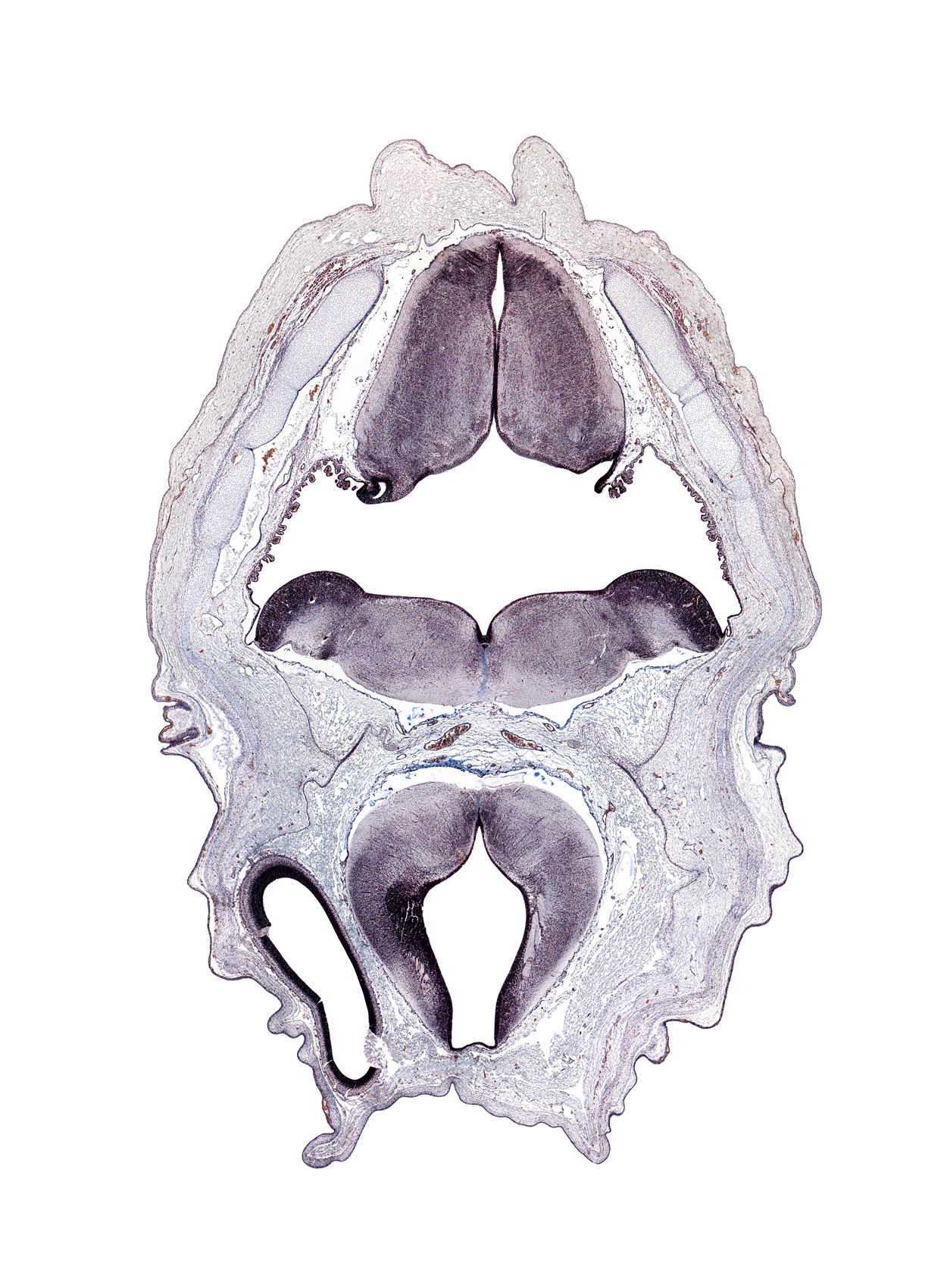 alar plate(s), facial nerve tract, hypoglossal nucleus, lateral ventricle, myelencephalon (medulla oblongata), red nucleus, roof plate of diencephalon, subarachnoid space, sulcus dorsalis, sulcus limitans, third ventricle, tractus solitarius, vestibular nucleus region