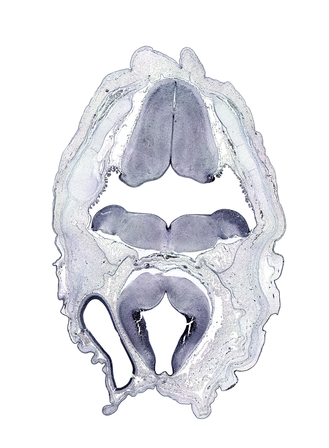 abducens nucleus, alar plate(s), artifact space(s), artifact(s), dural band for tentorium cerebelli, facial nerve tract, hypoglossal nucleus, lateral recess of rhombencoel (fourth ventricle), osteogenic layer, rectus capitis posterior major and minor muscles, semispinalis capitis muscle, splenius muscle, sulcus limitans, third ventricle, trapezius muscle