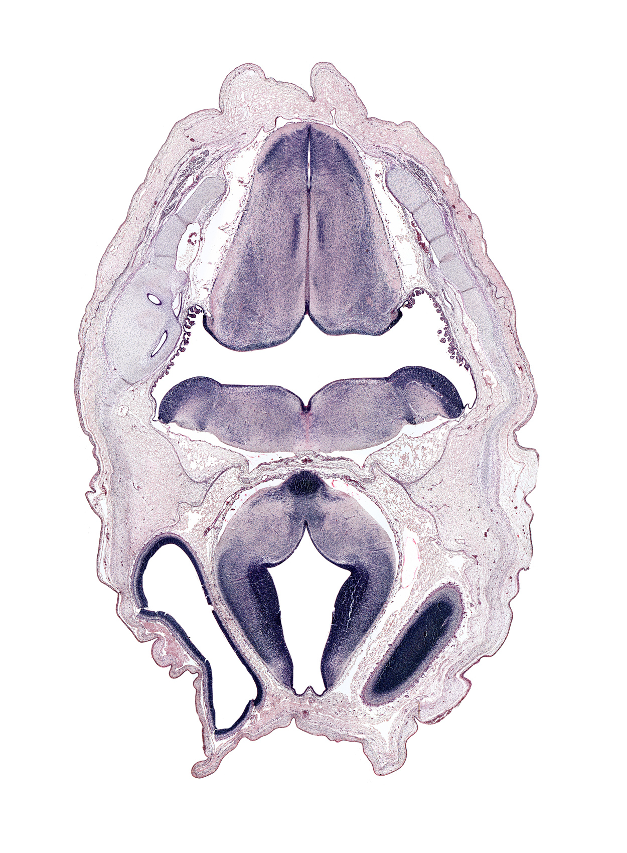 choroid plexus, dural limiting membrane, edge of cerebral vesicle (hemisphere), exoccipital, head mesenchyme, junction of diencephalon and mesencephalon, mamillary region, medial accessory olivary nucleus, median sulcus, oculomotor nerve (CN III), osteogenic layer, otic capsule, posterior cerebral artery, posterior dural venous plexus, roof plate of diencephalon, surface ectoderm, tractus solitarius nucleus