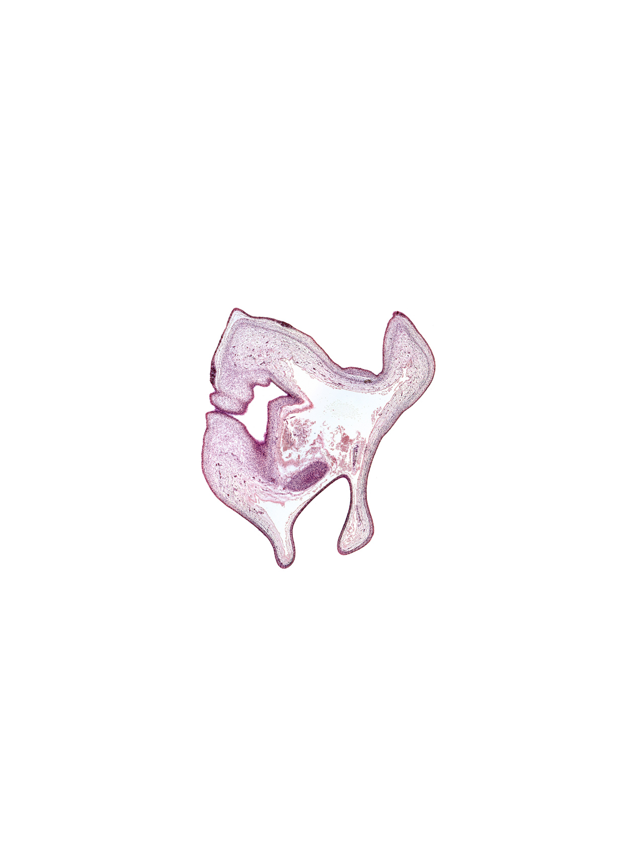 edge of roof plate of mesencephalon, head mesenchyme, subarachnoid space, surface ectoderm