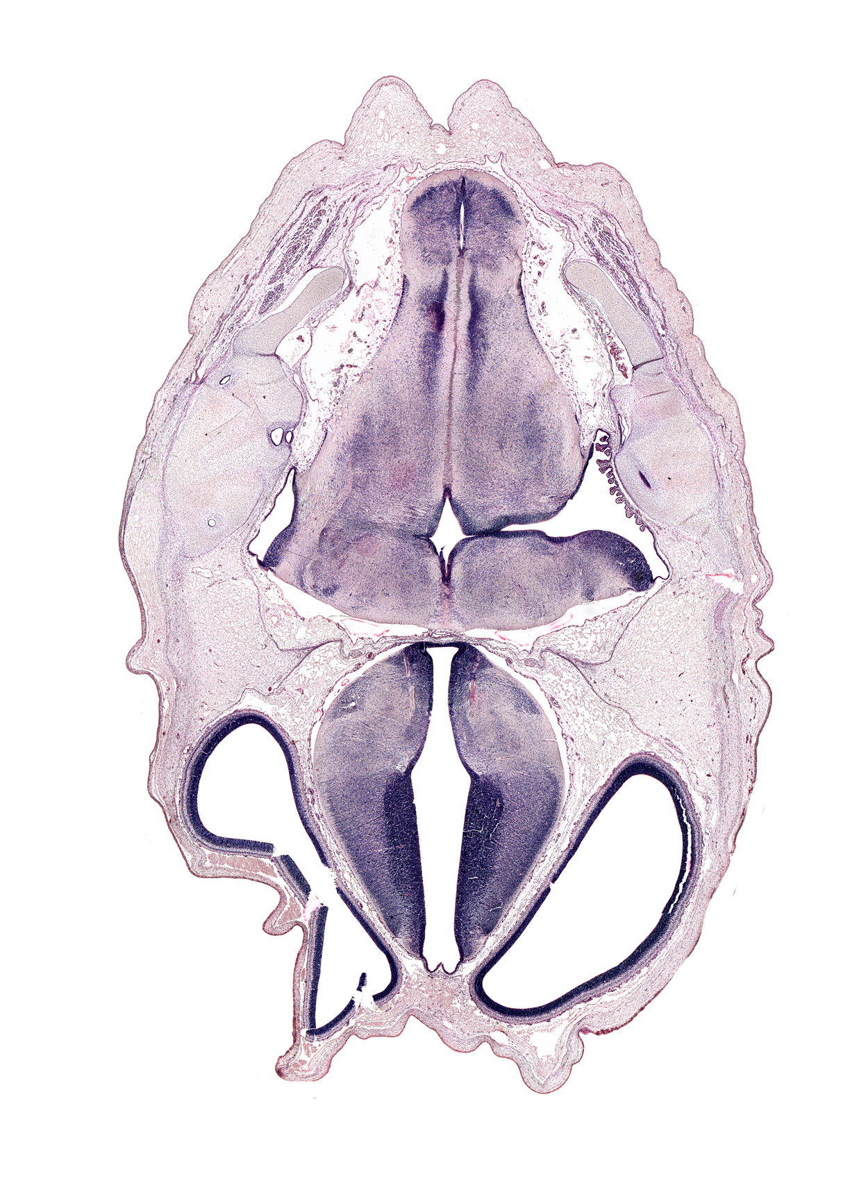 alar plate of metencephalon (cerebellum), decussation, dorsal thalamus, dural band for tentorium cerebelli, edge of anterior semicircular duct, endolymphatic sac, exoccipital, facial nerve tract, hypothalamic sulcus, lateral recess of rhombencoel (fourth ventricle), mamillothalamic tract, medial accessory olivary nucleus, nucleus cuneatus, nucleus gracilis, obliquus capitis superior muscle, posterior communicating artery, pyramidal tract region, semispinalis capitis muscle, spinal tract of trigeminal nerve (CN V), subarachnoid space, third ventricle, ventral thalamus