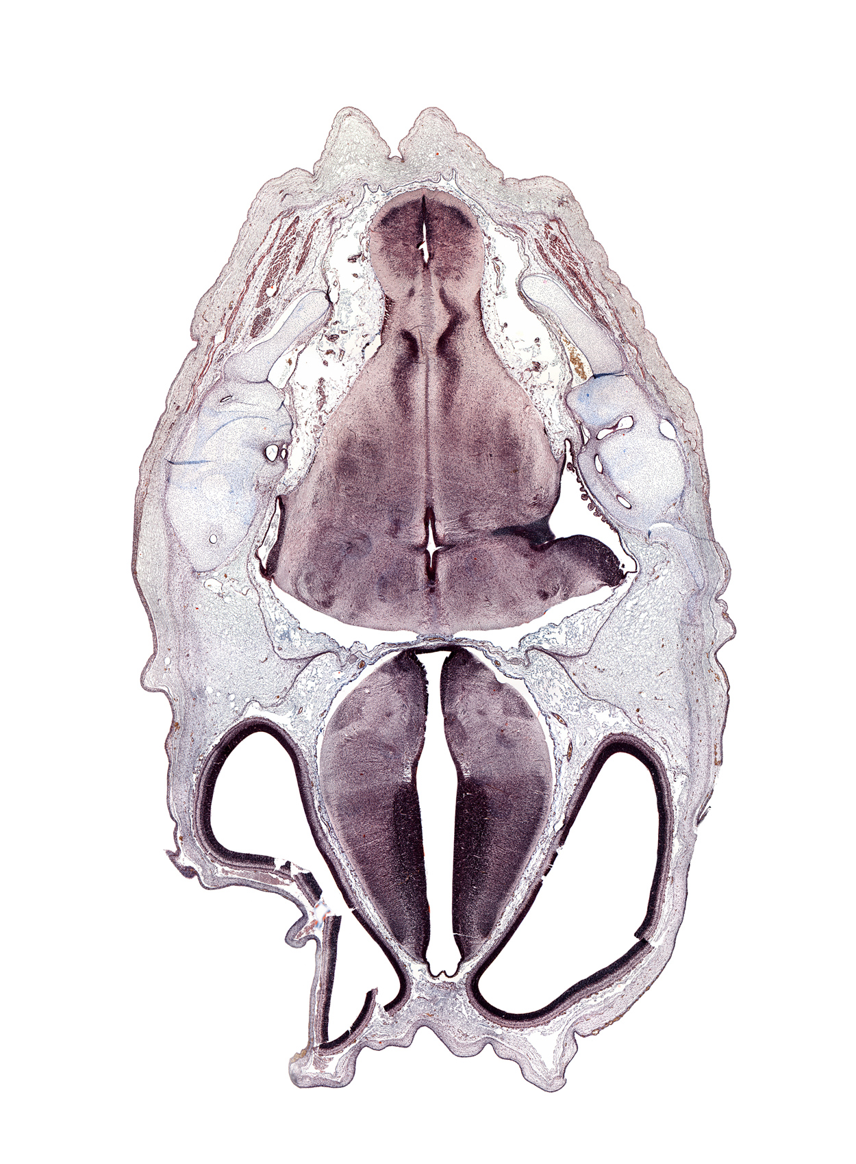 anterior semicircular duct, artifact(s), caudal edge of lateral recess of rhombencoel (fourth ventricle), decussation of medial lemniscus, exoccipital, facial nerve tract, fasciculus cuneatus, fasciculus gracilis, hypothalamic sulcus, medial accessory olivary nucleus, medial longitudinal fasciculus, medulla oblongata, osteogenic layer, posterior semicircular duct, subarachnoid space