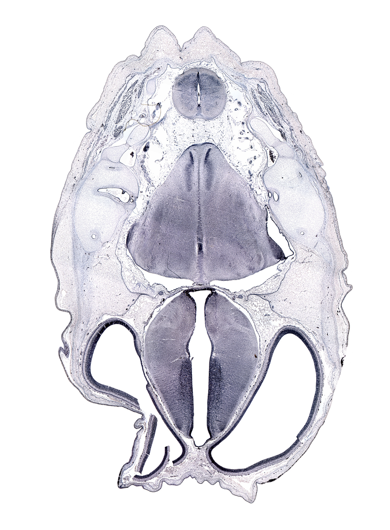 anterior semicircular duct, artifact space(s), common crus of anterior and posterior semicircular ducts, decussation, exoccipital, facial nerve tract, hypothalamic sulcus, jugular foramen, lateral ventricle, medial accessory olivary nucleus, medulla oblongata, nucleus cuneatus, nucleus gracilis, obliquus capitis superior muscle, posterior arch of C-1 vertebra (atlas), posterior semicircular duct, region of cervical flexure, roof plate of diencephalon, semispinalis capitis muscle, third ventricle, tract of abducens nerve (CN VI)