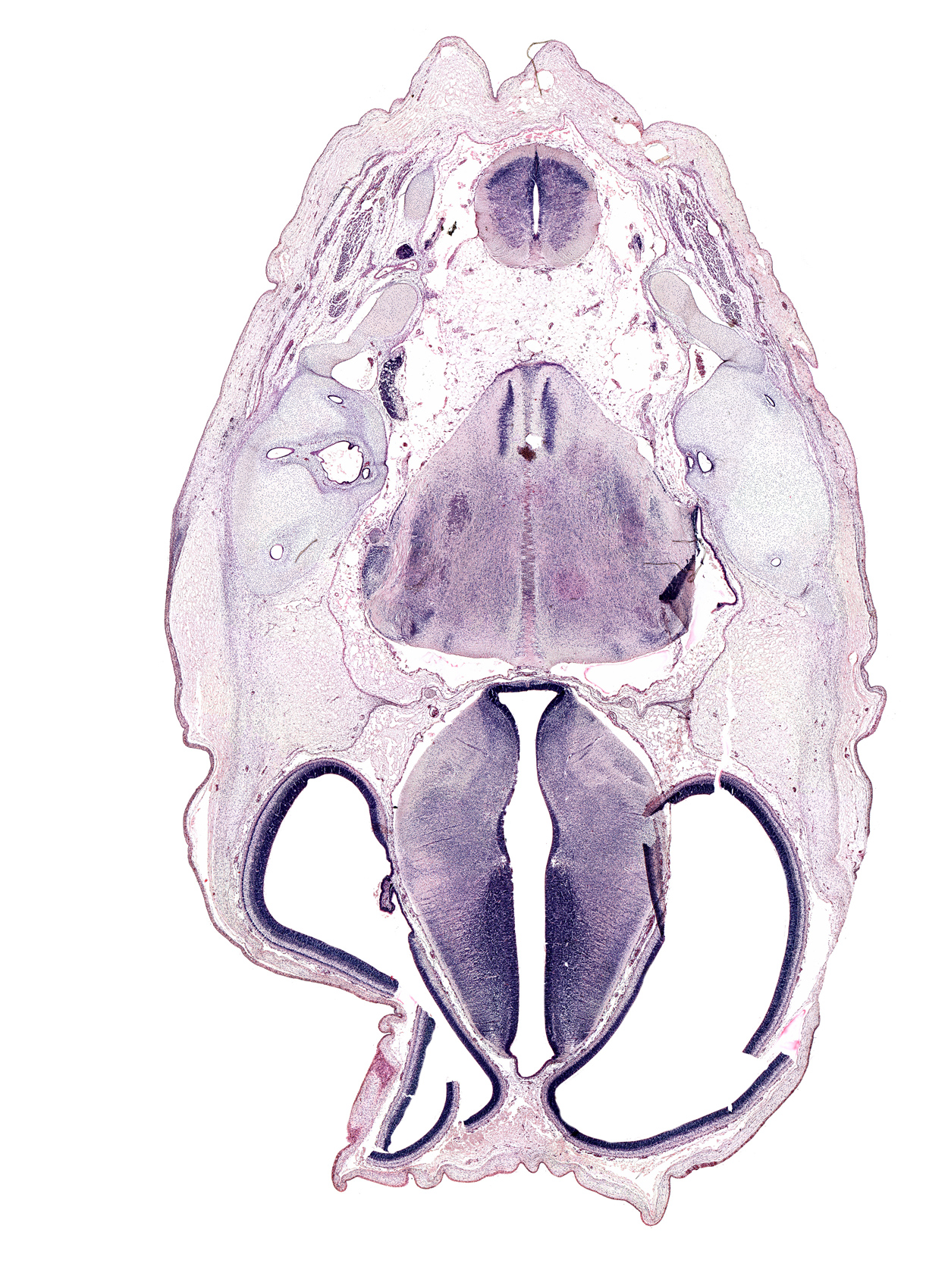 accessory nerve (CN XI), anterior semicircular duct, artifact fold, artifact fracture(s), artifact space(s), basilar artery, decussation, dorsal thalamus, endolymphatic duct, exoccipital, hypothalamic sulcus, hypothalamus, junction of brain and spinal cord, lateral ventricle, longissimus capitis muscle, medial accessory olivary nucleus, posterior arch of C-1 vertebra (atlas), posterior communicating artery, region of cervical flexure, root of glossopharyngeal nerve (CN IX), root of vagus nerve (CN X), spinal tract of trigeminal nerve (CN V), sulcus dorsalis, third ventricle, ventral thalamus, vertebral artery