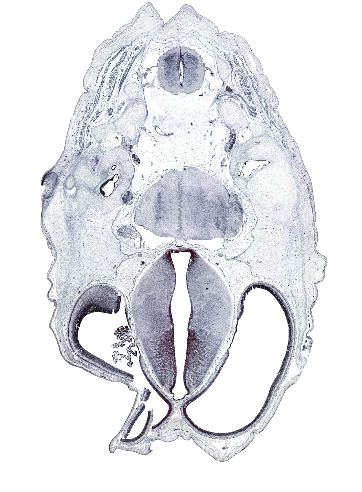 C-1 spinal ganglion, artifact space(s), artifact(s), decussation, dorsal median septum, dorsal thalamus, glossopharyngeal nerve (CN IX), hypothalamic sulcus, hypothalamus, nucleus of spinal tract of trigeminal nerve, obliquus capitis superior muscle, posterior arch of C-1 vertebra (atlas), root of vestibulocochlear nerve (CN VIII), semispinalis capitis muscle, splenius muscle, sulcus dorsalis, superior ganglion of vagus nerve (CN X), trapezius muscle, utricle, ventral thalamus, zona limitans intrathalamica