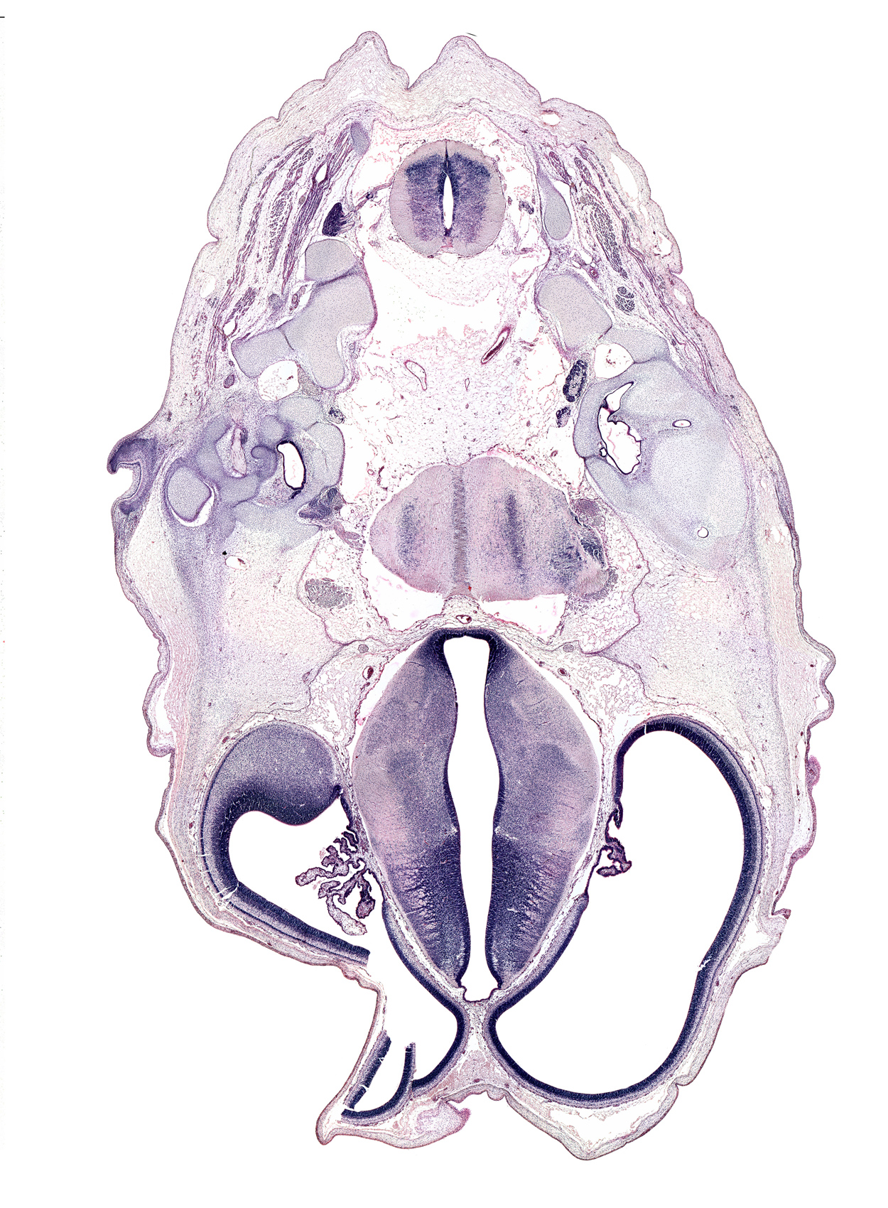 C-1 / C-2 interganglion region, anterior semicircular duct, artifact space(s), basilar artery, dorsal horn of grey matter, dorsal thalamus, fasciculus cuneatus, fasciculus gracilis, hypothalamic sulcus, hypothalamus, internal jugular vein, lateral semicircular duct, marginal ridge, nucleus of spinal tract of trigeminal nerve, oculomotor nerve (CN III), osteogenic layer, posterior arch of C-1 vertebra (atlas), roof plate of diencephalon, root of facial nerve (CN VII), root of trigeminal nerve (CN V), saccule(s), spinal accessory nerve (CN XI), subarachnoid space, sulcus dorsalis, superior ganglion of glossopharyngeal nerve (CN IX), superior ganglion of vagus nerve (CN X), trochlear nerve (CN IV), ventral horn of grey matter, ventral thalamus, vertebral artery