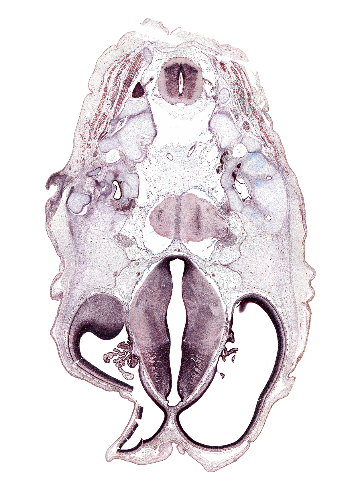 anterior semicircular duct, artifact space(s), artifact(s), atlanto-occipital joint, choroid plexus, decussation, facial nerve (CN VII), foramen magnum region, glossopharyngeal nerve (CN IX), internal jugular vein, lateral semicircular duct, obliquus capitis superior muscle, posterior arch of C-1 vertebra (atlas), roof plate of diencephalon, spinal accessory nerve (CN XI), subarachnoid space, sulcus dorsalis, transverse process of C-1 vertebra (atlas), utricle, vagus nerve (CN X), vertebral artery