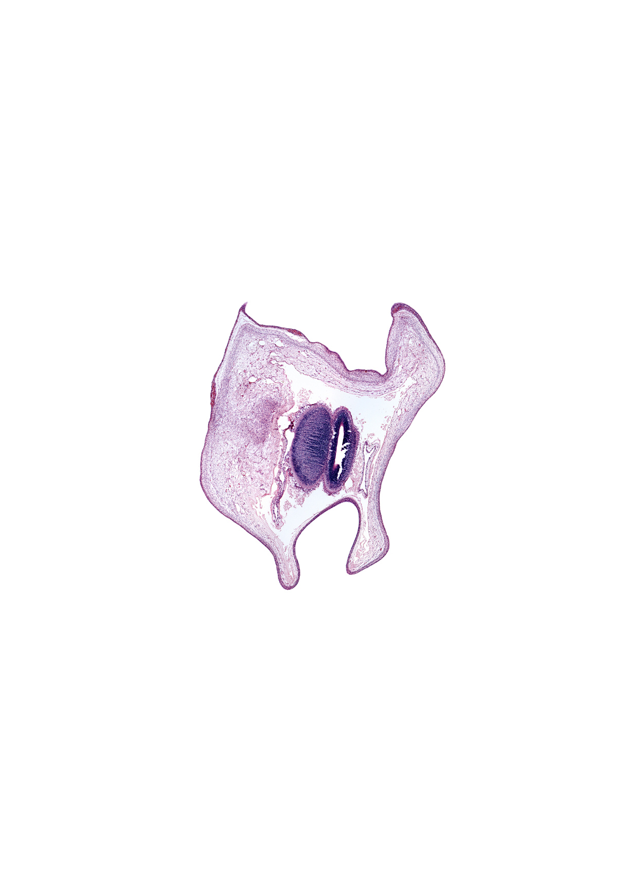 artifact fracture(s), head mesenchyme, roof plate of mesencephalon, subarachnoid space