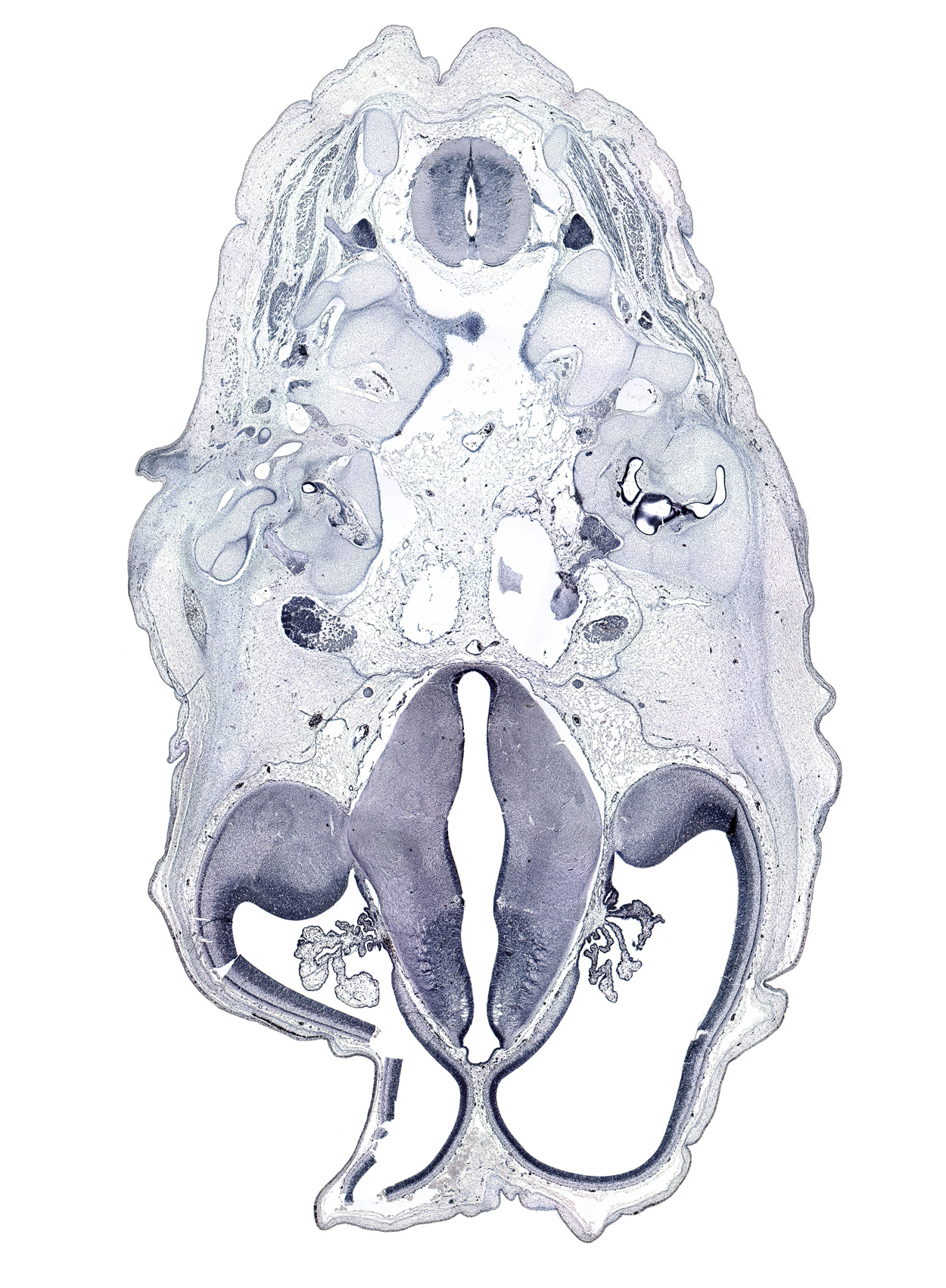 C-2 spinal ganglion, artifact space(s), artifact(s), cerebral vesicle (hemisphere), dorsal funiculus, dorsal thalamus, hypothalamic sulcus, lateral funiculus, lateral semicircular duct, marginal ridge, otic capsule cartilage, posterior arch of C-2 vertebra (axis), root of facial nerve (CN VII), root of trigeminal nerve (CN V), subarachnoid space, temporalis muscle, ventral funiculus, ventral thalamus, vestibulocochlear ganglion (CN VIII), zona limitans intrathalamica