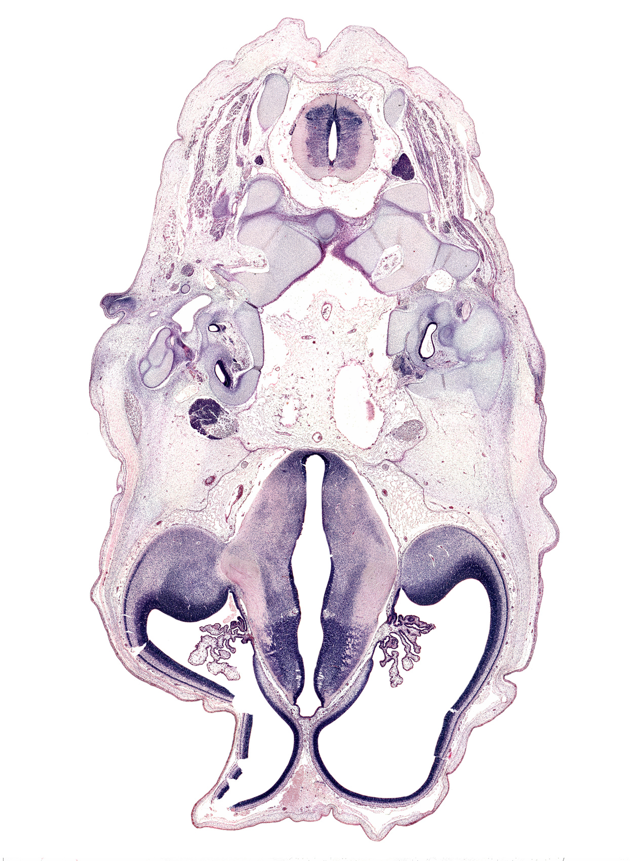 C-2 spinal ganglion, artifact space(s), atlanto-occipital joint, basi-occipital (basal plate), basilar artery, cerebral vesicle (hemisphere), dens of C-2 vertebra (axis), dorsal thalamus, dural band for tentorium cerebelli, facial nerve (CN VII), glossopharyngeal nerve (CN IX), hypoglossal canal, hypoglossal nerve (CN XII), hypothalamic sulcus, hypothalamus, intermediate zone, internal jugular vein, lateral mass of C-1 vertebra (atlas), marginal zone, obliquus capitis inferior muscle, oculomotor nerve (CN III), osteogenic layer, posterior arch of C-2 vertebra (axis), posterior communicating artery, roof plate of diencephalon, root of trigeminal nerve (CN V), semispinalis cervicis muscle, spinal accessory nerve (CN XI), subarachnoid space, sulcus dorsalis, sulcus medius, trochlear nerve (CN IV), vagus nerve (CN X), ventral thalamus, ventricular zone, zona limitans intrathalamica