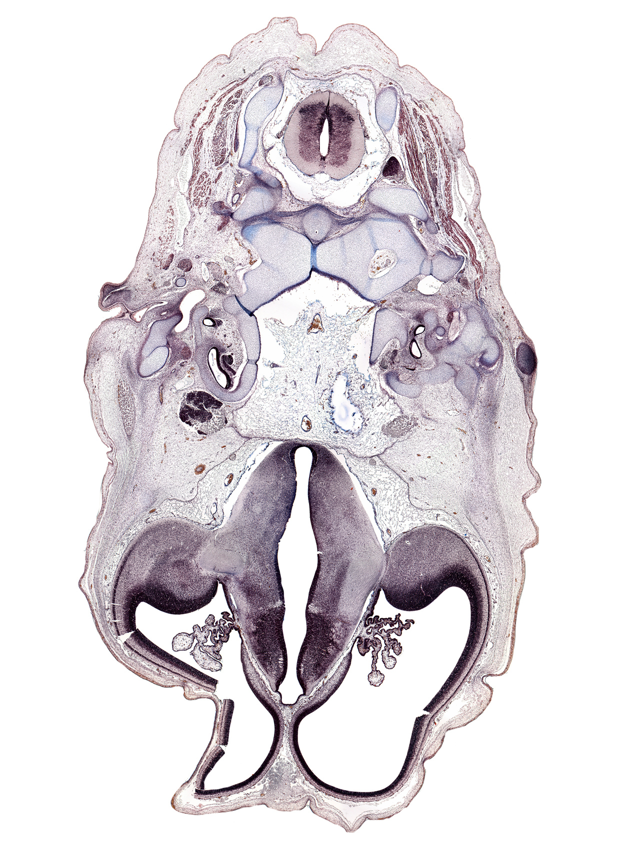 C-2 spinal ganglion, artifact(s), auricle, choroid plexus, cochlear duct, cortical plate, dens of C-2 vertebra (axis), dura mater, facial nerve (CN VII), hippocampus, hypoglossal nerve (CN XII), internal capsule, internal jugular vein, lateral ventricle, lateral ventricular eminence (telencephalon), neural arch of C-2 vertebra (axis), pyriform cortex, stapedius muscle, subarachnoid space, third ventricle, transverse ligament, vertebral artery