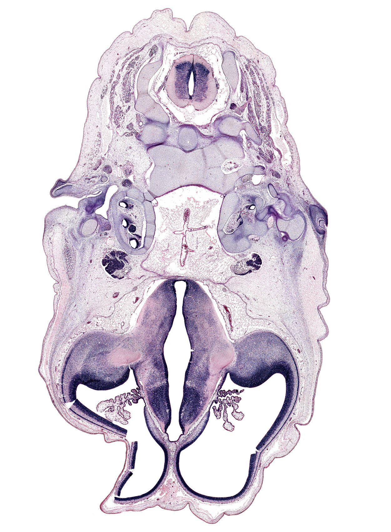 C-2 spinal ganglion, artifact fracture(s), atlanto-occipital joint, basi-occipital (basal plate), basilar artery, cephalic edge of auricle, choroid fissure, choroid plexus, cortical plate, dens of C-2 vertebra (axis), external acoustic meatus, glossopharyngeal nerve (CN IX), hippocampus, hypothalamic sulcus, hypothalamus, incus, internal capsule, lateral ventricle, pharyngeal arch 1 cartilage (Meckel), posterior arch of C-2 vertebra (axis), posterior communicating artery, spinal accessory nerve (CN XI), splenius muscle, stapes, subarachnoid space, trigeminal ganglion (CN V), vagus and accessory nerves (CN X and CN XI)