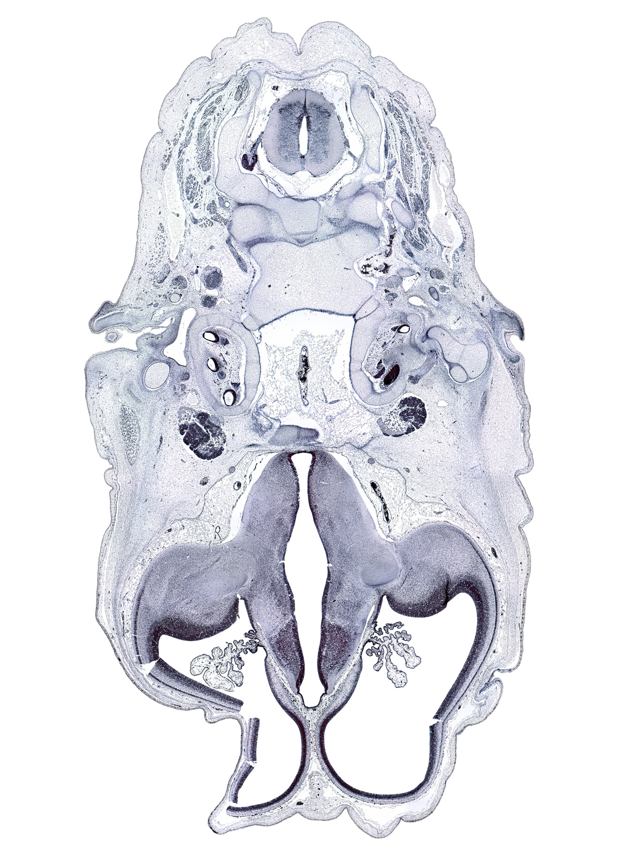 C-2 / C-3 interganglion region, artifact space(s), auricle, basi-occipital (basal plate), choroid plexus, dorsal funiculus, dorsal thalamus, external acoustic meatus, facial nerve (CN VII), geniculate ganglion (CN VII), incus, lateral funiculus, lateral ventricular eminence (telencephalon), levator scapulae muscle, malleus, motor root of trigeminal nerve (CN V), roof plate of diencephalon, splenius muscle, trigeminal ganglion (CN V), ventral funiculus, ventral thalamus