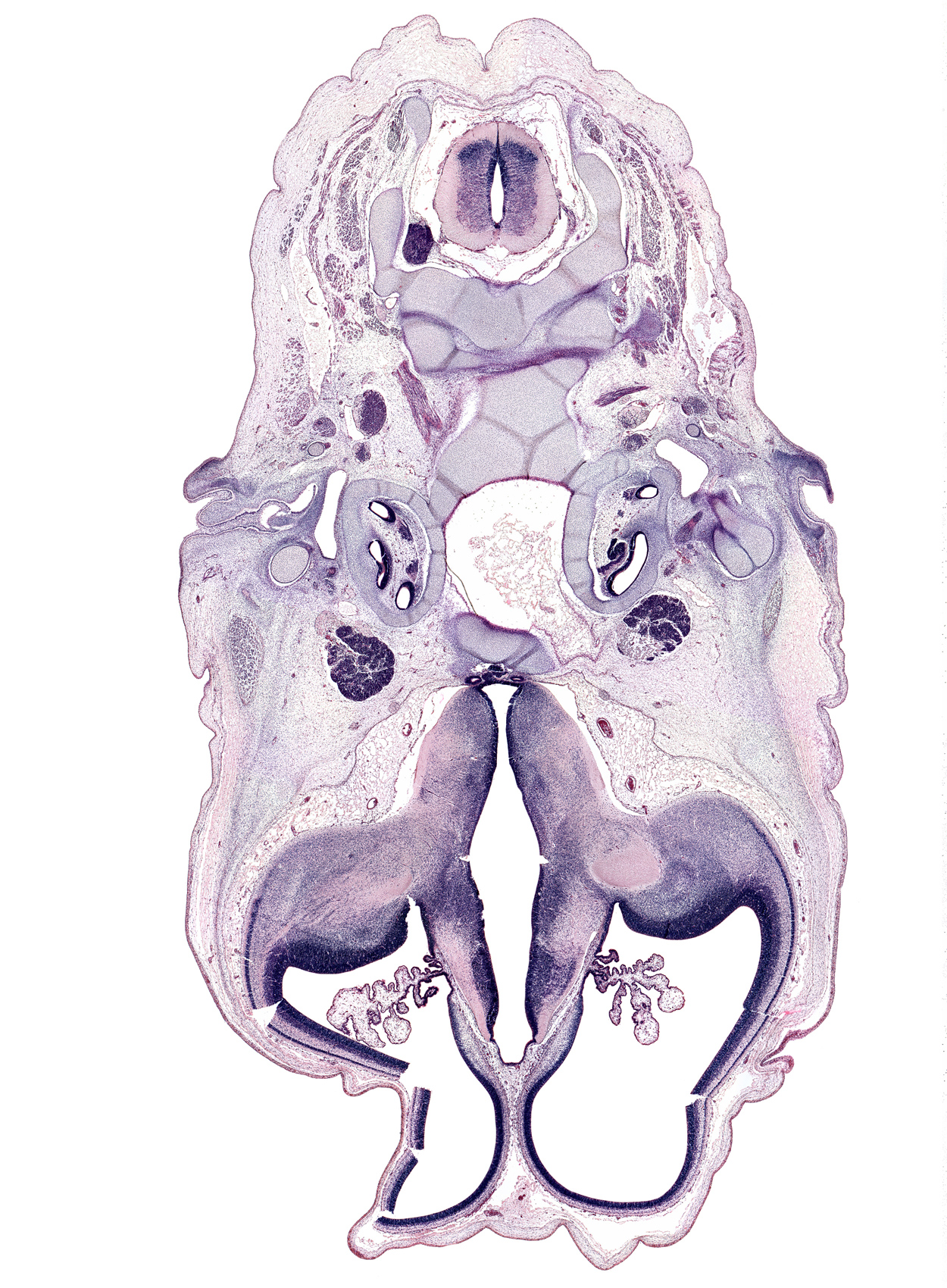 C-2 / C-3 interganglion region, abducens nerve (CN VI), artifact fracture(s), atlanto-axial joint, atlanto-occipital joint, auricle, central canal, choroid plexus, cochlear duct, dorsum sellae, hippocampus, hypothalamus, internal capsule, lateral ventricle, longissimus muscle, mandibular nerve (CN V₃), neurohypophysis, oculomotor nerve (CN III), pharyngeal arch 2 cartilage, posterior arch of C-2 vertebra (axis), posterior communicating artery, semispinalis capitis muscle, semispinalis cervicis muscle, spiral ganglion (CN VIII), splenius muscle, sternocleidomastoid muscle, subarachnoid space, transverse foramen, trapezius muscle, trigeminal ganglion (CN V), trochlear nerve (CN IV), tuberal part of adenohypophysis