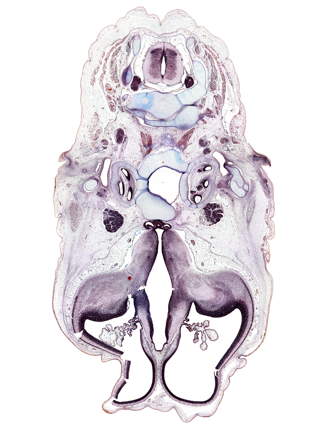 C-3 spinal ganglion, artifact(s), central canal, cochlear duct, dorsal median septum, dura mater, facial nerve (CN VII), glossopharyngeal nerve (CN IX), hypothalamic sulcus, hypothalamus, infundibular recess, insula area of neopallium, internal capsule, internal jugular vein, lateral ventricular eminence (telencephalon), mandibular nerve (CN V₃), neurohypophysis, otic ganglion, subthalamus, sulcus dorsalis, trigeminal ganglion (CN V), vagus nerve (CN X), vascular plexus, ventral median sulcus