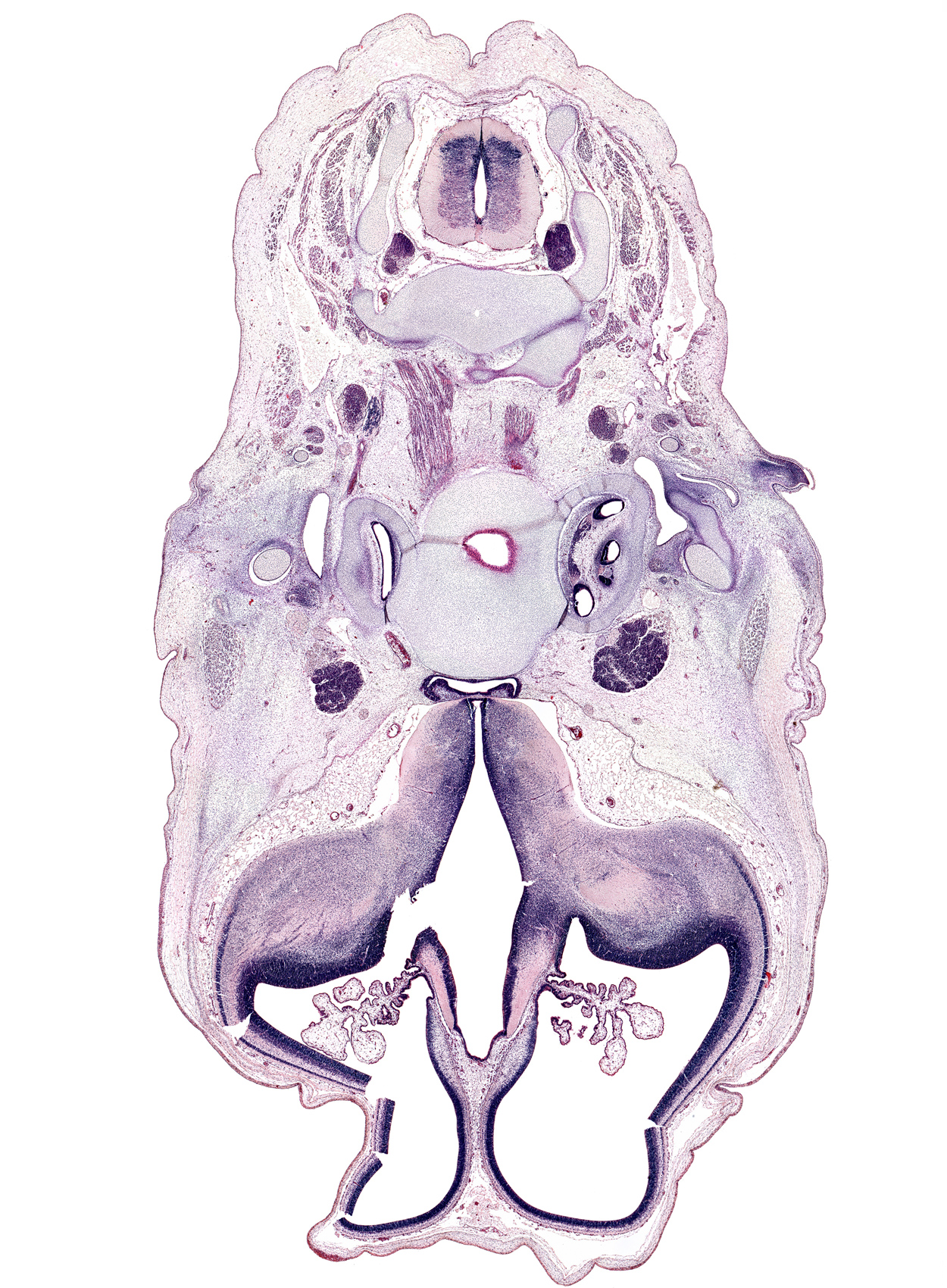 C-3 spinal ganglion, adenohypophysis, artifact(s), auricle, basi-occipital (basal plate), body of sphenoid, centrum of C-2 vertebra (axis), cephalic edge of pharynx, choroid plexus, cochlear duct, cortical plate, habenular commissure, inferior ganglion of glossopharyngeal nerve (CN IX), inferior ganglion of vagus nerve (CN X), internal capsule, internal carotid artery, interventricular foramen, lateral mass of C-1 vertebra (atlas), lateral ventricular eminence (telencephalon), longus capitis muscle, motor root of trigeminal nerve (CN V), neural arch of C-3 vertebra, optic tract, otic capsule, pharyngeal arch 2 cartilage, posterior communicating artery, residual lumen, spinal accessory nerve (CN XI), subarachnoid space, temporalis muscle, tympanic cavity