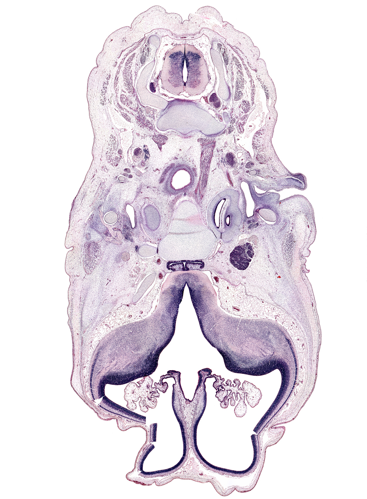 C-2 / C-3 intervertebral disc, C-3 spinal ganglion, adenohypophysis, basi-occipital (basal plate), centrum of C-2 vertebra (axis), cephalic edge of pharynx, choroid fissure, external acoustic meatus, glossopharyngeal nerve (CN IX), hippocampus, hypothalamus, inferior alveolar nerve, inferior ganglion of vagus nerve (CN X), internal capsule, internal carotid artery, interventricular foramen, lateral ventricular eminence (telencephalon), longus capitis muscle, mandibular nerve (CN V₃), medial ventricular eminence (diencephalon), neural arch of C-3 vertebra, paraphysis, pharyngeal arch 1 cartilage (Meckel), pharyngeal arch 2 cartilage, posterior communicating artery, sphenoid, splenius muscle, sternocleidomastoid muscle, subarachnoid space, temporalis muscle, trapezius muscle, trigeminal ganglion (CN V), vertebral artery