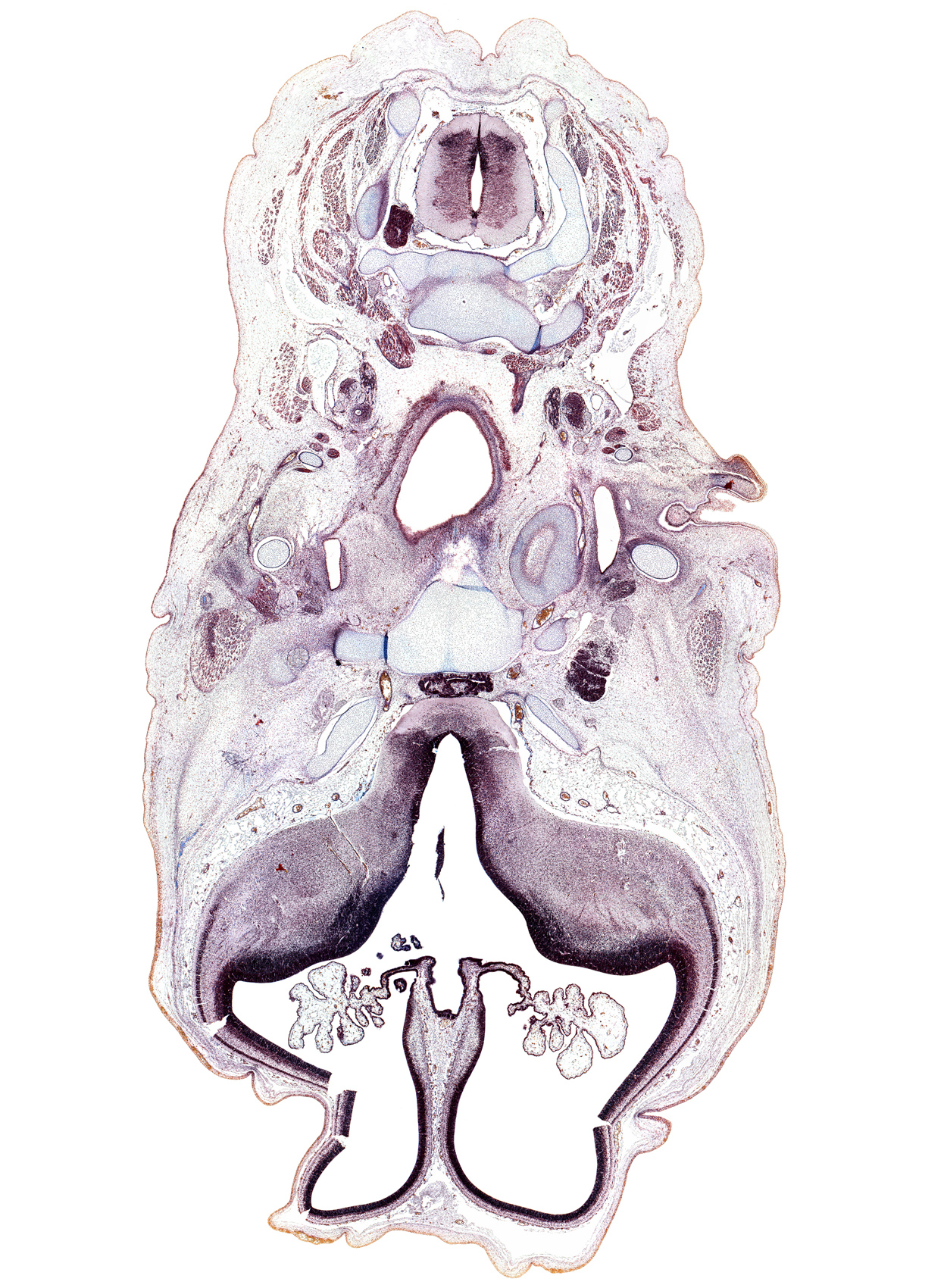 C-3 / C-4 interganglion region, C-3 spinal nerve, artifact(s), auricle, central canal, corpus striatum, cortical plate, internal carotid artery, jugular lymph sac, lateral ventricular eminence (telencephalon), otic ganglion, pharynx, retropharyngeal space, sternocleidomastoid muscle, supra-optic commissure, telencephalon medium, temporalis muscle, trapezius muscle, trigeminal ganglion (CN V)