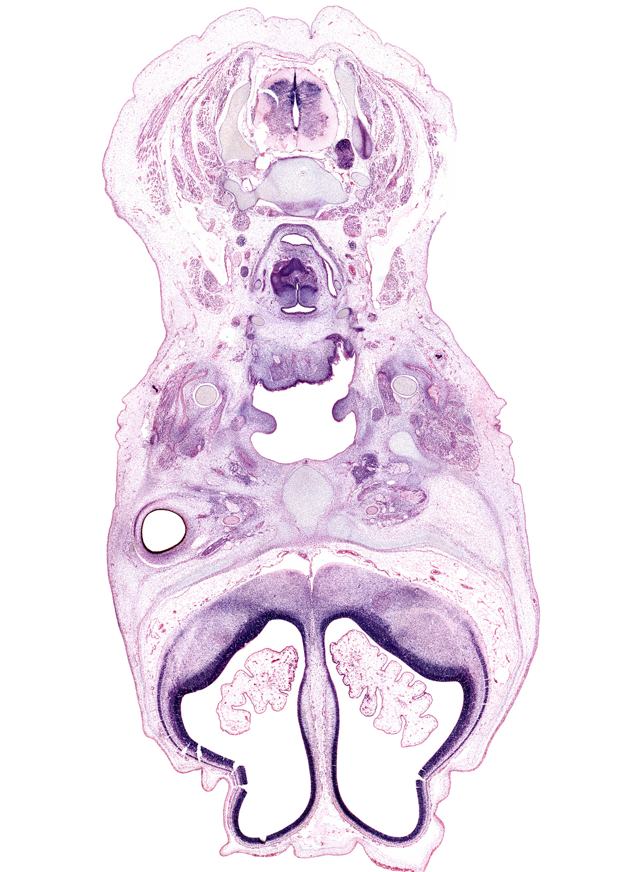 C-4 spinal nerve, C-5 spinal ganglion, artifact fracture(s), artifact separation(s), artifact tear, centrum of C-4 vertebra, choroid plexus, cortical plate, dorsal horn of grey matter, epithelial lamina, ethmoid, falx cerebri region, glossopharyngeal nerve (CN IX), laryngeal pharynx, lateral ventricle, lateral ventricular eminence (telencephalon), masseter muscle, maxillary nerve (CN V₂), optic nerve (CN II), palatine shelf, pigmented layer of retina, root of tongue, sphenopalatine ganglion, splenius muscle, sternocleidomastoid muscle, subarachnoid space, trapezius muscle, vascular plexus, ventral horn of grey matter, ventricle (of brain)