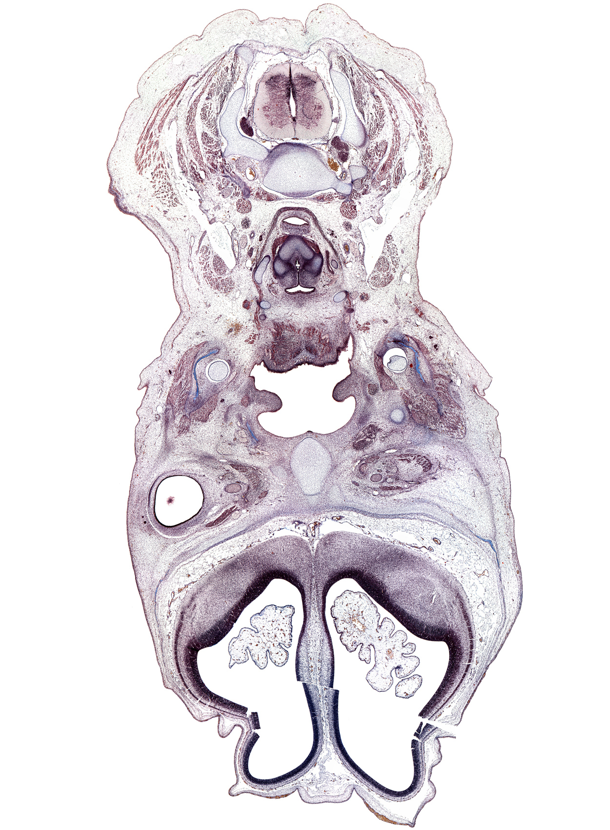 C-5 spinal ganglion, artifact(s), caudal part of laryngeal pharynx, central canal, cortical plate, digastric tendon, ethmoid, glossopharyngeal nerve (CN IX), jugular lymph sac, lacrimal gland buds, mandible, masseter muscle, medial pterygoid muscle, palatine shelf, parotid gland, platysma muscle, surface ectoderm, sympathetic trunk, transverse foramen