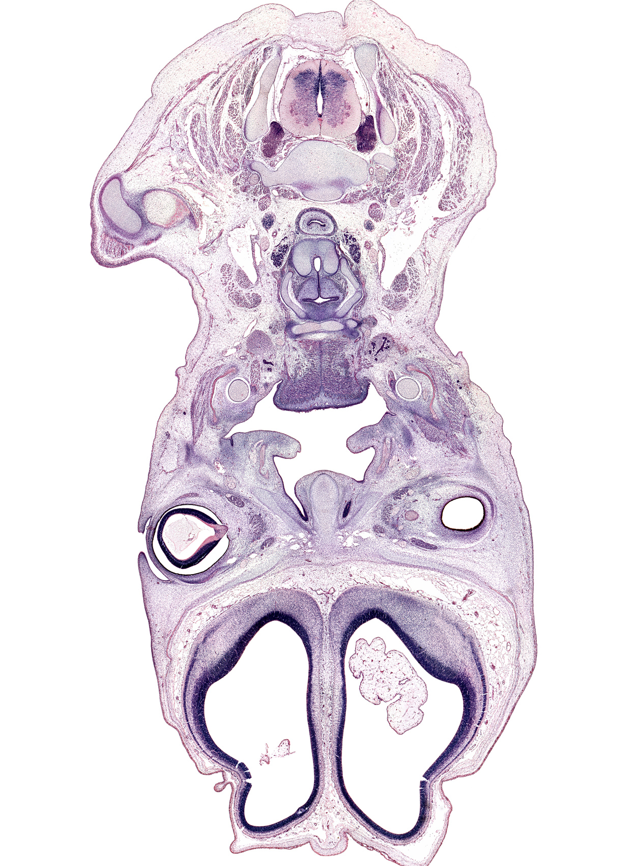 C-4 / C-5 intervertebral disc, C-5 spinal nerve, C-6 spinal ganglion, anterior communicating artery, artifact fracture(s), body of hyoid (pharyngeal arch 3 cartilage), centrum of C-5 vertebra, choroid plexus, common carotid artery, cricoid cartilage, falx cerebri region, hypoglossal nerve (CN XII), infra-orbital nerve, intraretinal space (optic vesicle cavity), jugular lymph sac, lateral ventricle, levator scapulae muscle, masseter muscle, neural layer of retina, pharyngeal arch 1 cartilage (Meckel), pigmented layer of retina, sternocleidomastoid muscle, subarachnoid space, submandibular gland, sympathetic trunk, thyroid cartilage, tongue raphe