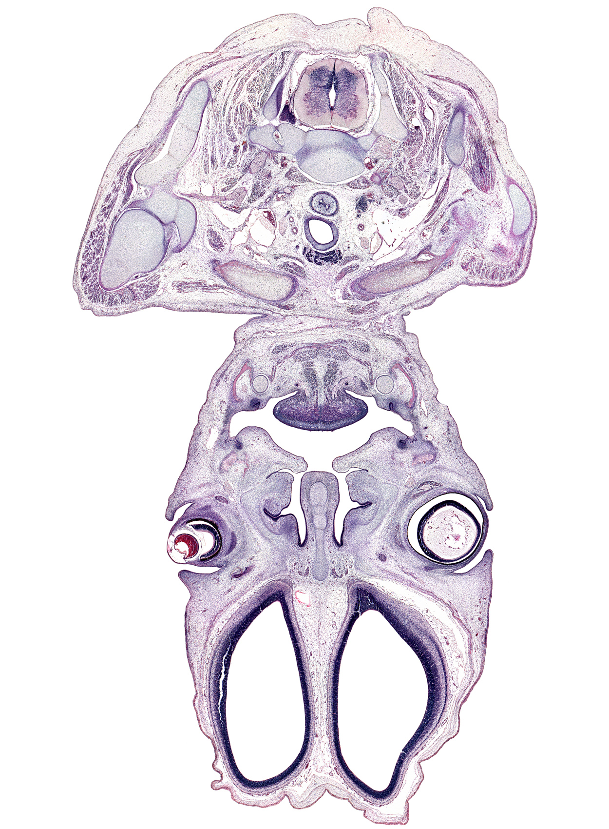 C-6 / C-7 intervertebral disc, C-7 / C-8 interganglion region, C-7 spinal nerve, anterior belly of digastric muscle, anterior scalene muscle, central canal, cerebral vesicle (hemisphere), clavicle, common carotid artery, cornea, dorsal horn of grey matter, genioglossus muscle, hyaloid cavity, inferior belly of omohyoid muscle, infra-orbital lamina (facial muscle blastemata), infra-orbital nerve, internal jugular vein, intraretinal space (optic vesicle cavity), isthmus of thyroid gland, lateral ventricle, lingual nerve, mandible, mylohyoid muscle, olfactory bulb, olfactory epithelium (placode), olfactory filia (CN I), optic cup cavity, parotid duct, pharyngeal arch 1 cartilage (Meckel), platysma muscle, trapezius muscle, upper eyelid, vagus nerve (CN X), ventral horn of grey matter