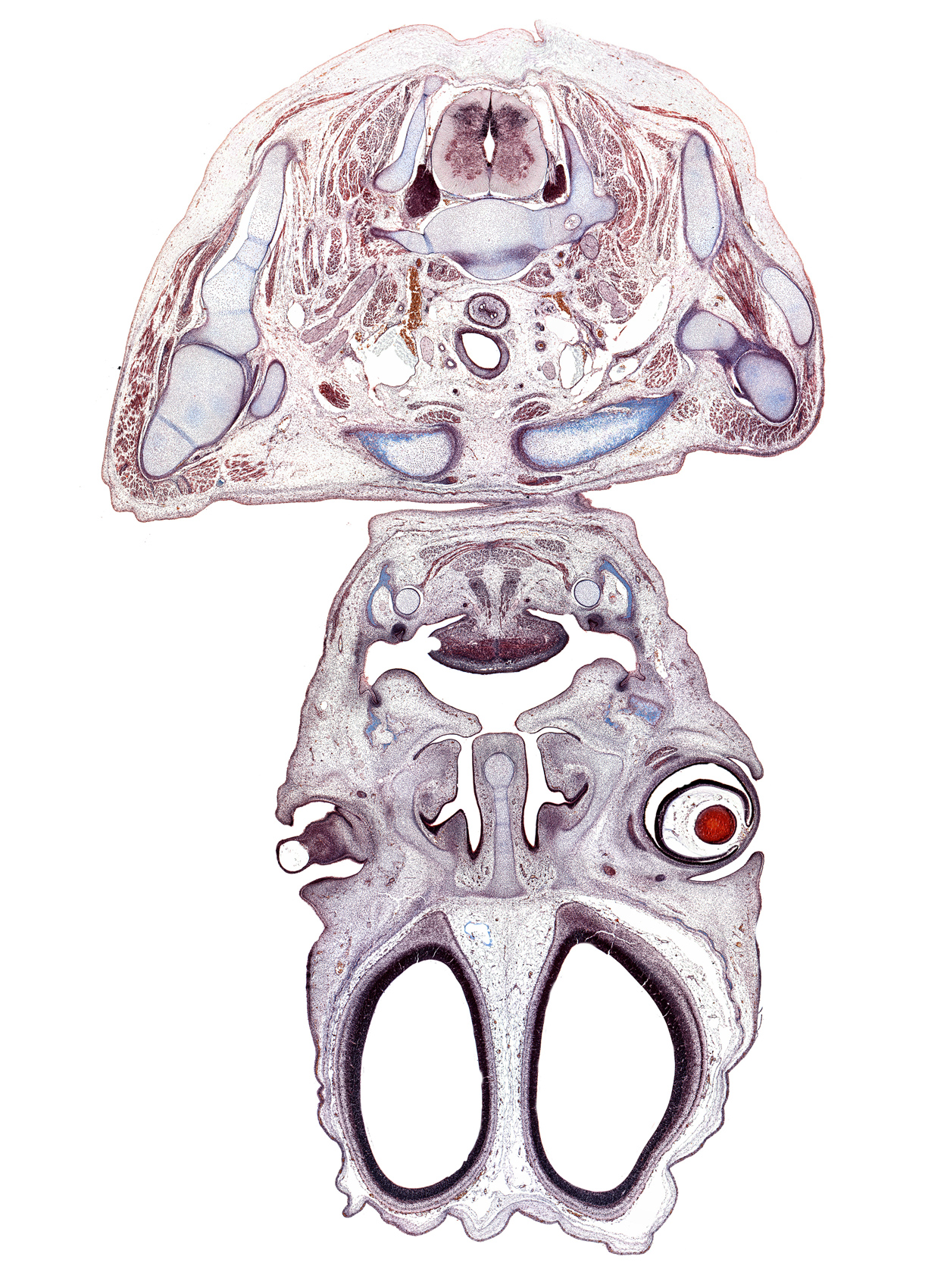 C-8 spinal ganglion, cerebral vesicle (hemisphere), clavicle, coracoid process of scapula, cornea, cortical plate, deltoid muscle, esophagus, facial artery, internal jugular vein, jugular lymph sac, lateral ventricle, lower eyelid, maxilla, middle scalene muscle, nasolacrimal duct, olfactory bulb, platysma muscle, scapula, transverse foramen of C-7 vertebra, upper eyelid