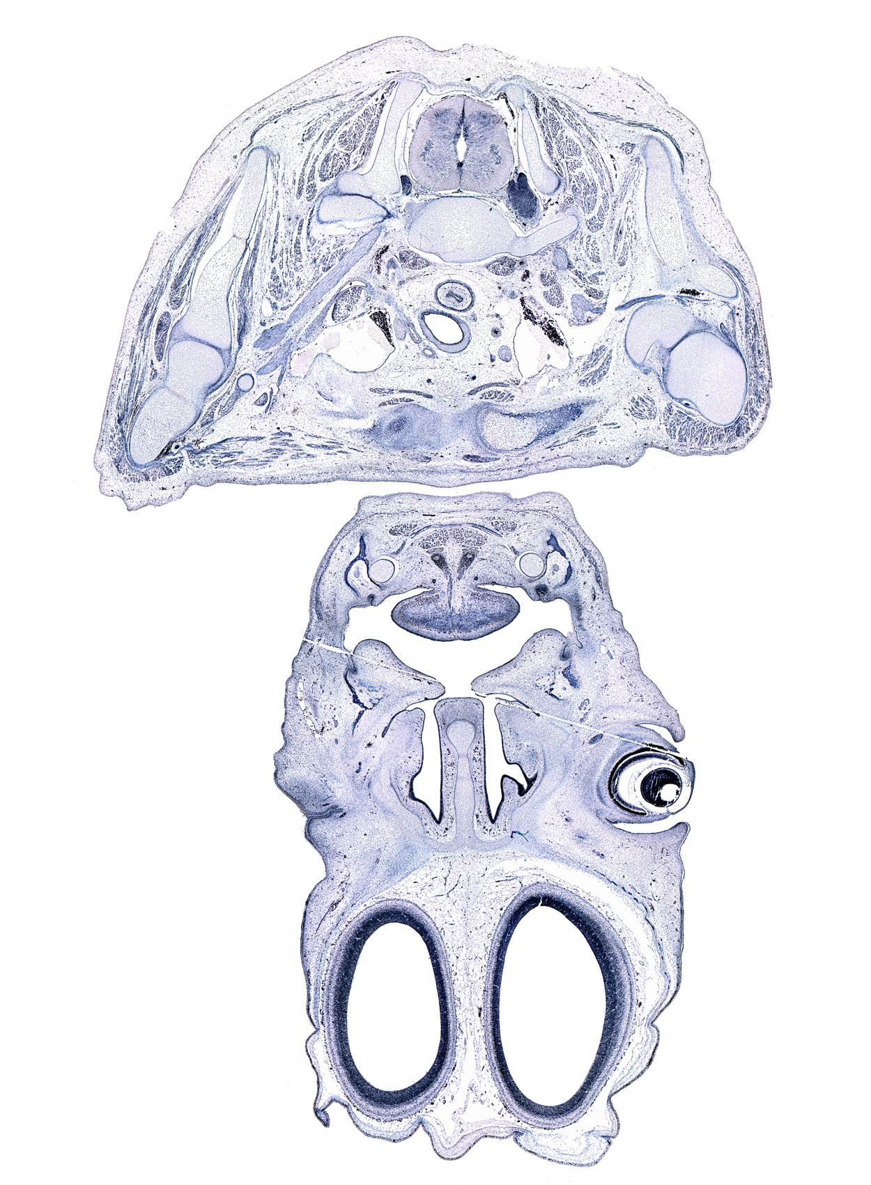 C-8 spinal ganglion, anterior scalene muscle, artifact(s), cornea, dorsal funiculus, genioglossus muscle, inferior nasal concha, internal jugular vein, lateral funiculus, lens, lower eyelid, medial junction of eyelids, middle scalene muscle, mylohyoid muscle, sternohyoid muscle, sternothyroid muscle, subarachnoid space, subclavian vein, submandibular duct, subscapularis muscle, ventral funiculus