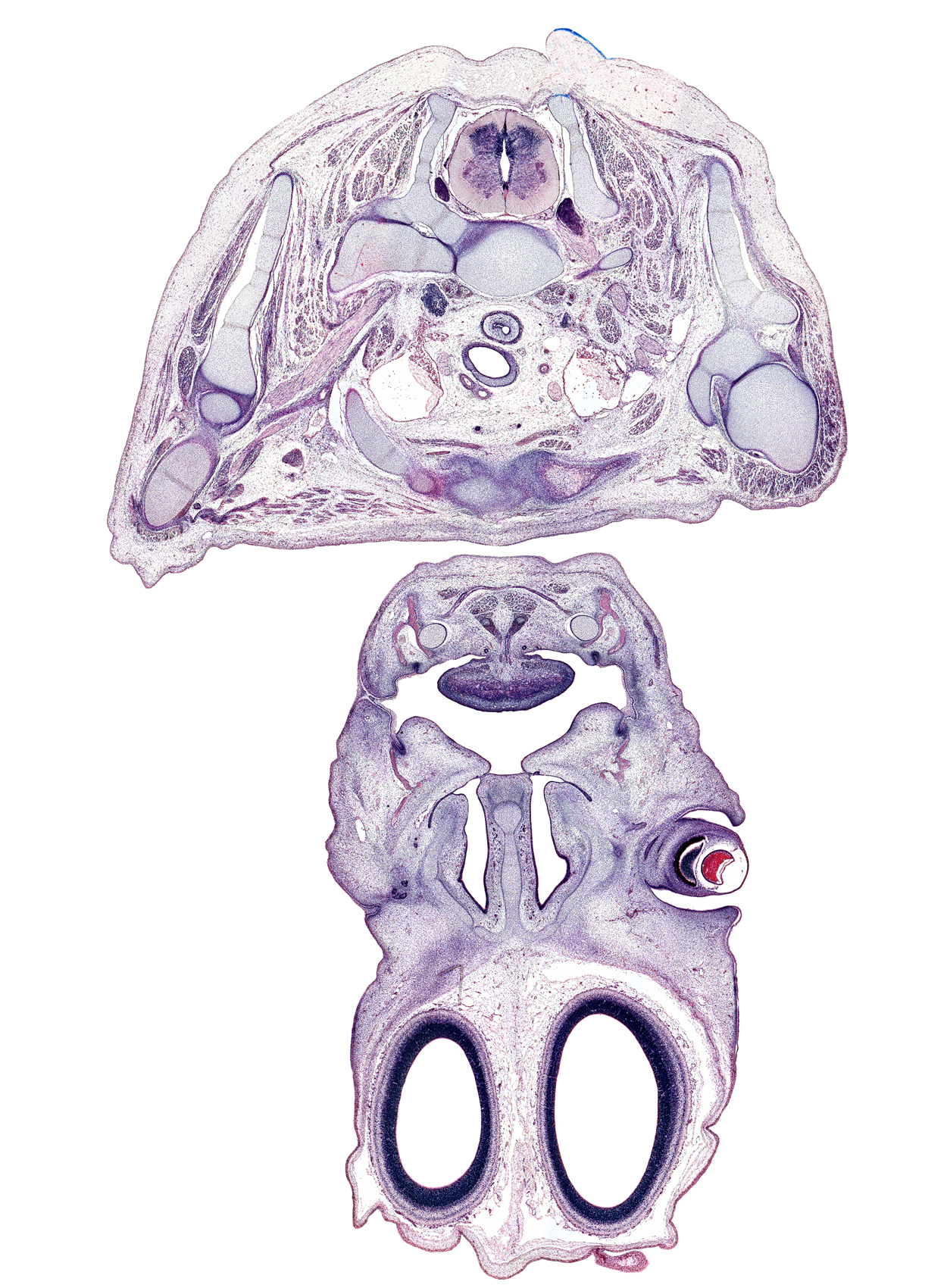 C-7 / T-1 intervertebral disc, C-8 spinal ganglion, C-8 spinal nerve, anterior belly of digastric muscle, axillary artery, axillary nerve, cerebral vesicle (hemisphere), clavicle, dorsal horn of grey matter, dorsal median septum, inferior nasal concha, internal jugular vein, junction of nasal septum and palatine shelf, left common carotid artery, lens, lower eyelid, mandible, middle trunk of brachial plexus (C-7), musculocutaneous nerve, mylohyoid muscle, nasal septal cartilage, palatine shelf, right brachiocephalic vein, scapula, sternohyoid muscle, sternothyroid muscle, subarachnoid space, sympathetic trunk, trachea, upper eyelid, vagus nerve (CN X), ventral horn of grey matter