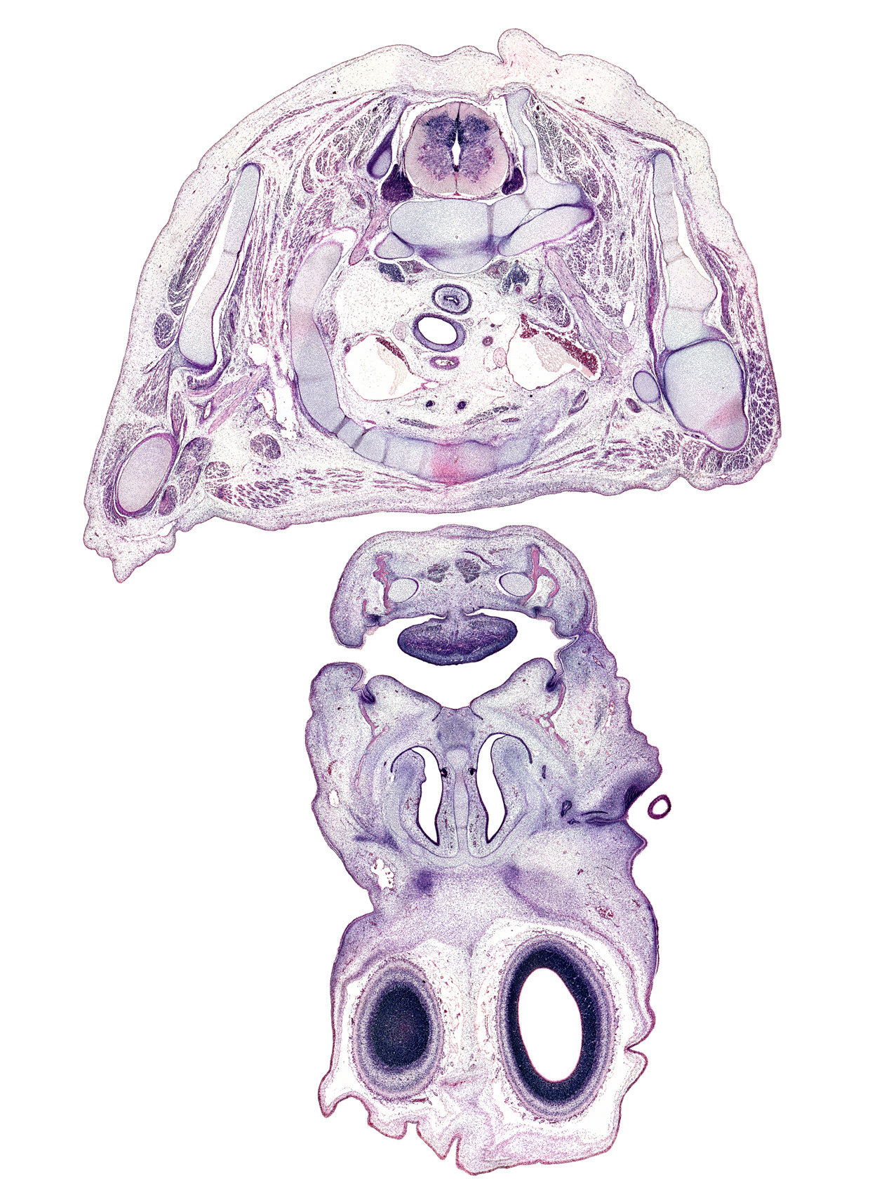 C-7 / T-1 intervertebral disc, T-1 spinal ganglion, axillary nerve, brachial plexus, brachiocephalic artery, centrum of T-1 vertebra, cerebral vesicle (hemisphere), deltoid muscle, edge of cerebral vesicle (hemisphere), edge of eyeball, edge of lateral ventricle, esophagus, glenohumeral joint, head of rib 1, inferior nasal concha, internal jugular vein, left common carotid artery, manubrium of sternum, neural arch of T-1 vertebra, rhomboid minor muscle, rib 1, right brachiocephalic vein, scapula, semispinalis capitis muscle, semispinalis cervicis muscle, splenius muscle, subclavian vein, tooth bud(s), trachea, trapezius muscle, vomeronasal organ