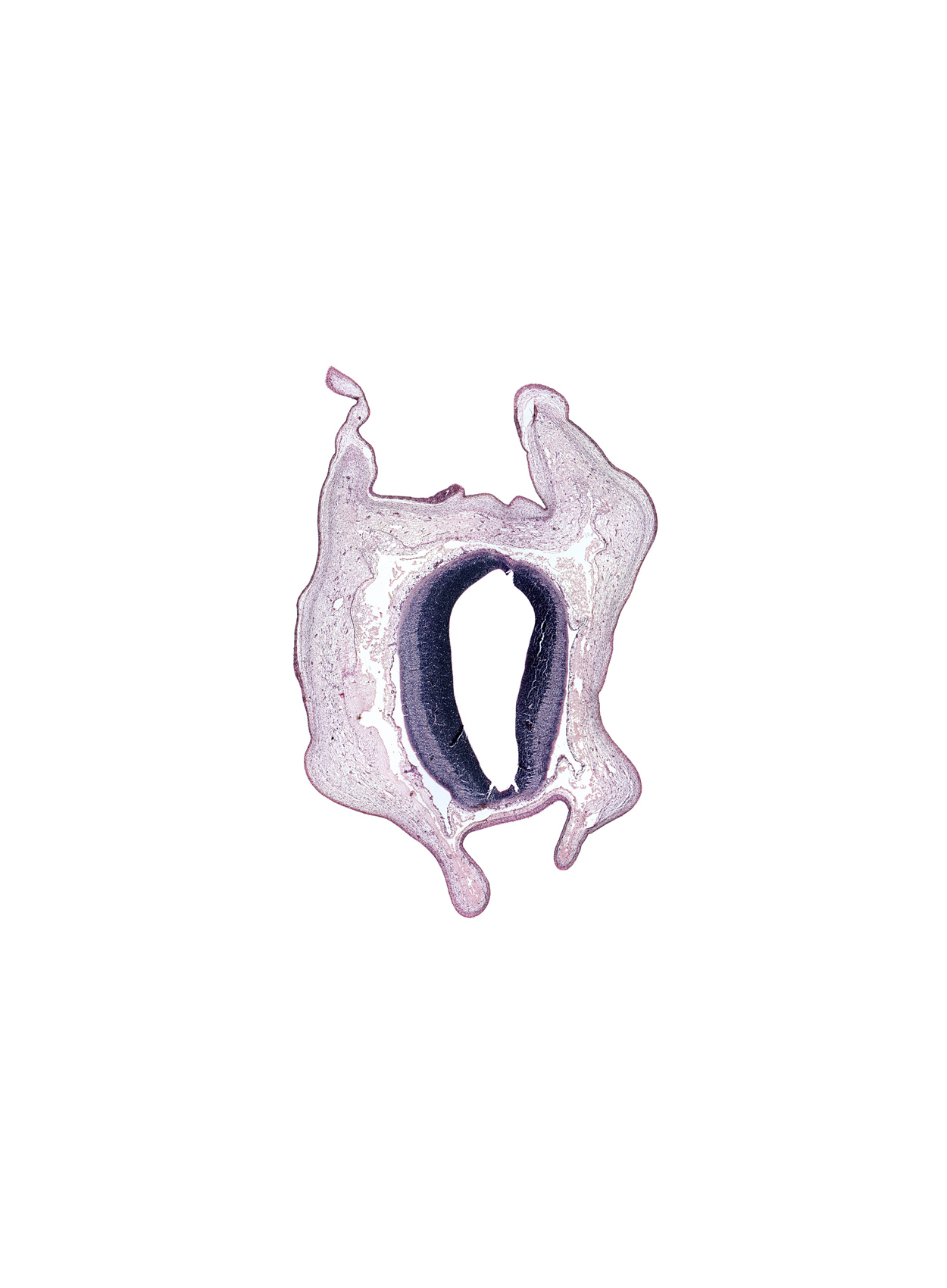 alar plate of mesencephalon, artifact fracture(s), artifact space(s), cerebral aqueduct of mesencephalon, intermediate zone, marginal zone, roof plate, ventricular zone