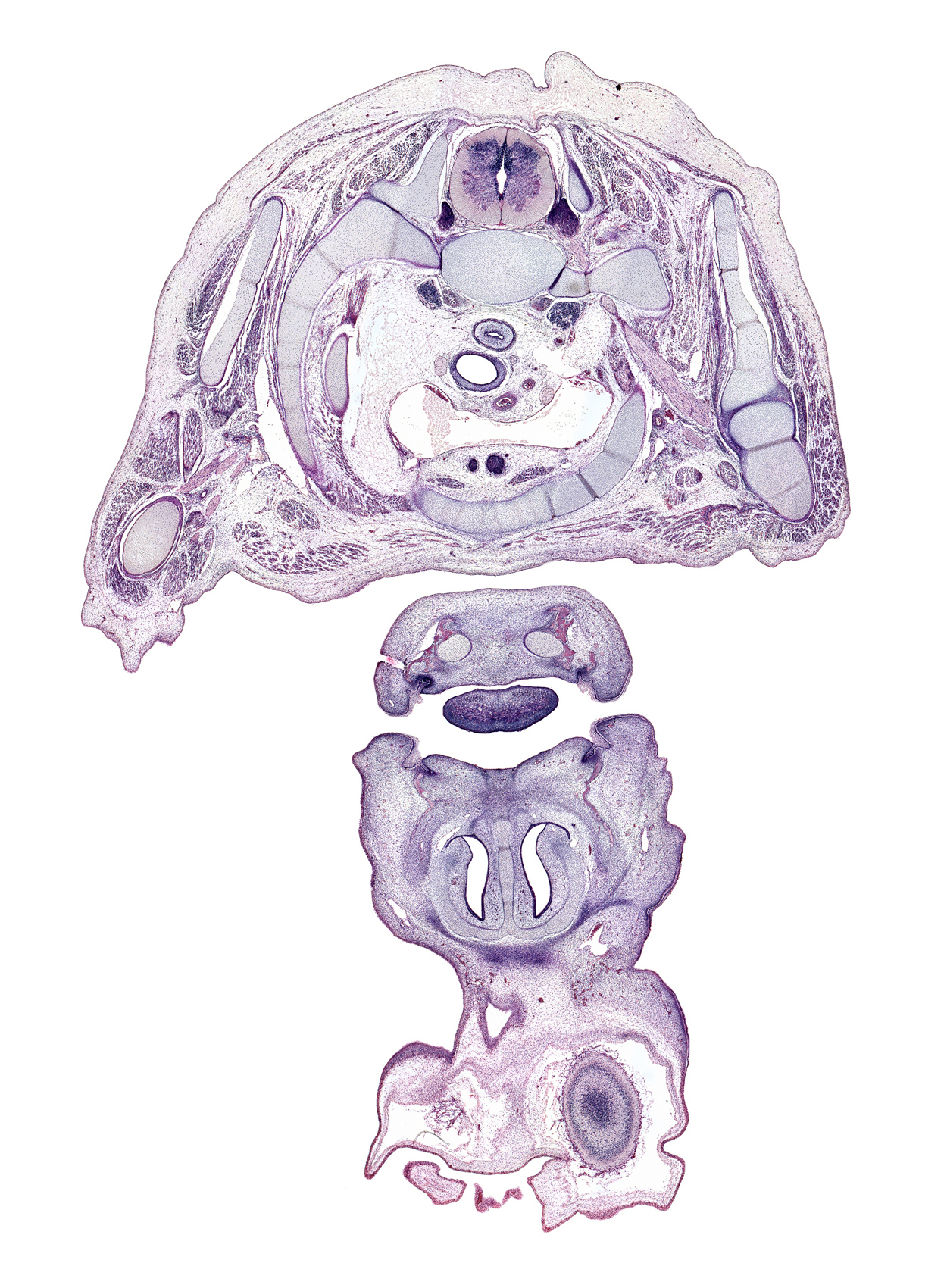 T-1 dorsal primary ramus, T-1 spinal ganglion, T-1 spinal nerve, anterior scalene muscle, artifact fracture(s), axillary artery, brachial plexus cords, brachiocephalic artery, centrum of T-1 vertebra, edge of frontal prominence, frontal edge of cerebral vesicle (hemisphere), inferior cervical sympathetic ganglion, interorbital ligament, lateral head of triceps brachii muscle, left brachiocephalic vein, left common carotid artery, left subclavian artery, long head of triceps brachii muscle, lower lip, nasal capsule cartilage, nasal cavity (nasal sac), neural arch, oral cavity, primary palate, radial nerve, rib 1, subarachnoid space, upper lip, vagus nerve (CN X), vascular plexus