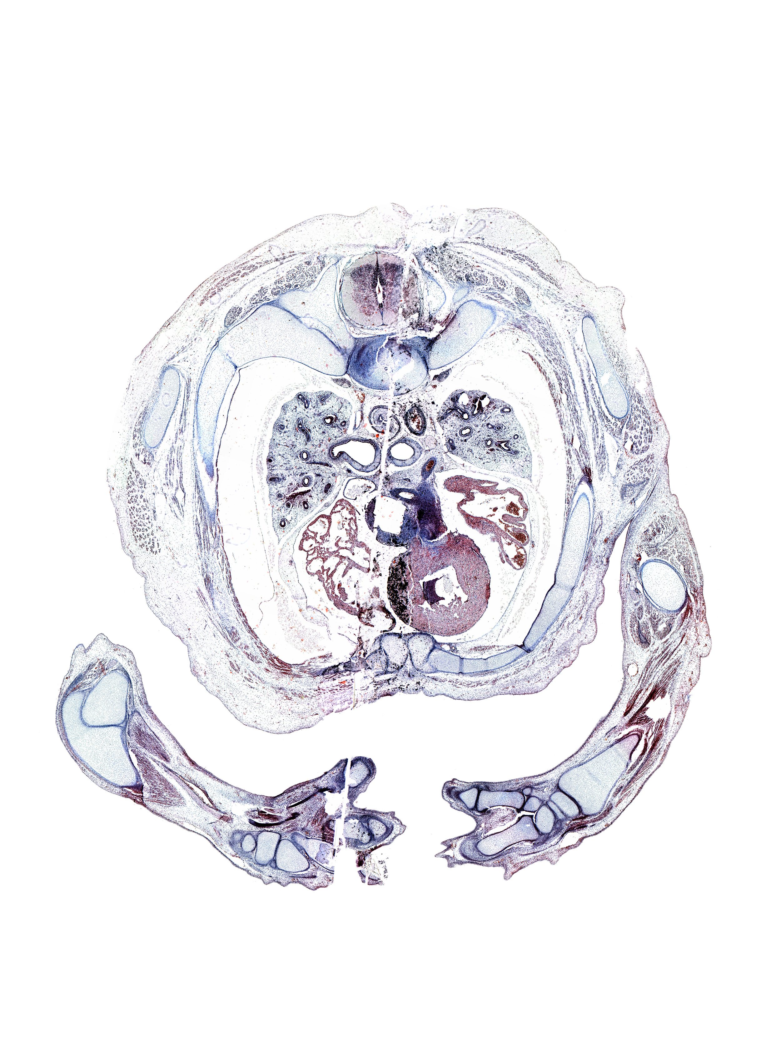 T-3 / T-4 interganglion region, artifact(s), edge of ulna, hamate, humerus, iliocostalis muscle, latissimus dorsi muscle, longissimus muscle, metacarpal 4, olecranon process of ulna, pulmogenic mesenchyme, radius, rhomboid major muscle, rib 4, scapula, spinalis muscle, triceps brachii tendon, triquetrum, trochlea of humerus, ulna, upper secondary bronchus