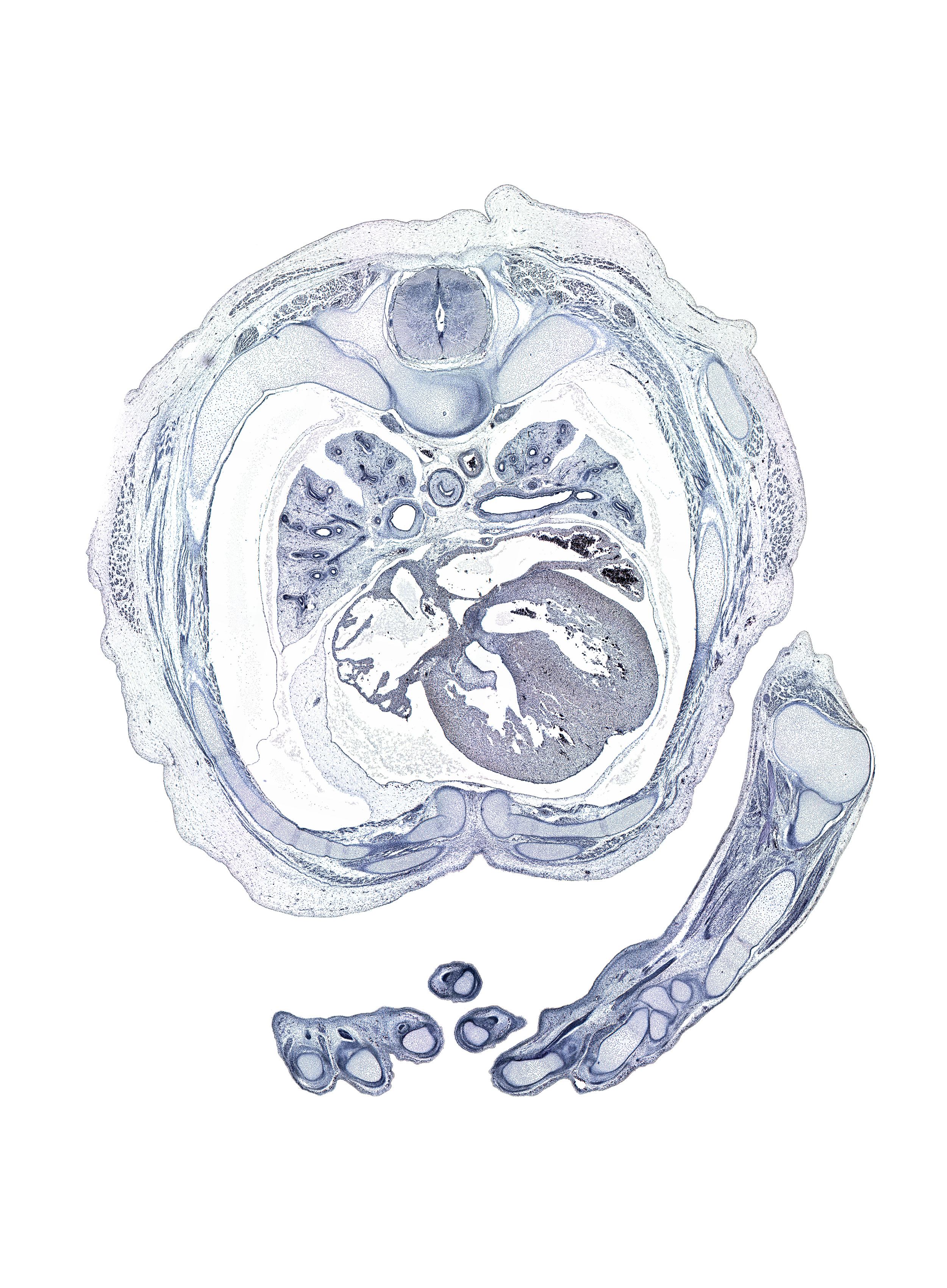 T-4 / T-5 interganglion region, aponeurosis of external abdominal oblique muscle, central canal, distal end of ulna, dorsum of hand, external intercostal muscle(s), head of radius, head of rib 5, hemisternum, humerus, iliocostalis muscle, inferior tertiary bronchus, innermost intercostal muscle(s), intermediate phalynx of left digit 2 (index finger), latissimus dorsi muscle, longissimus muscle, metacarpal 4, musculi pectinati, oblique fissure, pleural cavity, proximal phalynx of digit 3 (middle finger), radiohumeral joint, rib 5, rib 6, rib 7, serratus anterior muscle, sinus venosus, spinalis muscle, sternocostal muscle, sympathetic trunk, upper lobe of left lung, upper secondary bronchus