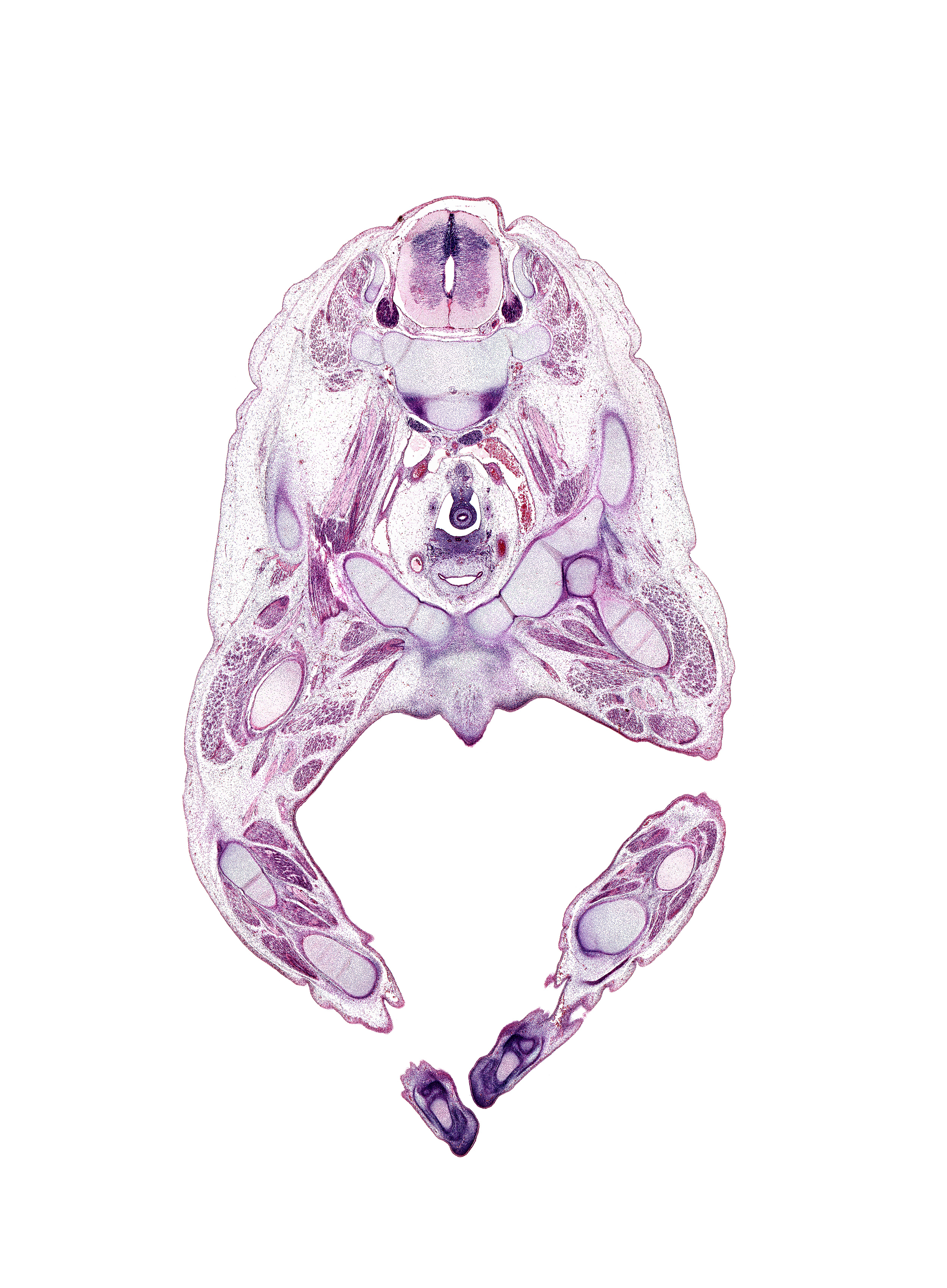 L-3 spinal ganglion, L-4 / L-5 intervertebral disc, cephalic edge of penis, common iliac artery, common iliac vein, femoral nerve, fibula, flexor digitorum longus muscle, iliopsoas tendon, ilium, left umbilical artery, medial malleolus of tibia, metatarsal 1 head, proximal phalynx of digit 1 (foot), quadratus lumborum muscle, rectum, right ureter, sciatic nerve, scrotal swelling, soleus muscle, superior pubic ramus, tibia, tibial nerve, tibialis anterior muscle, urinary bladder trigone