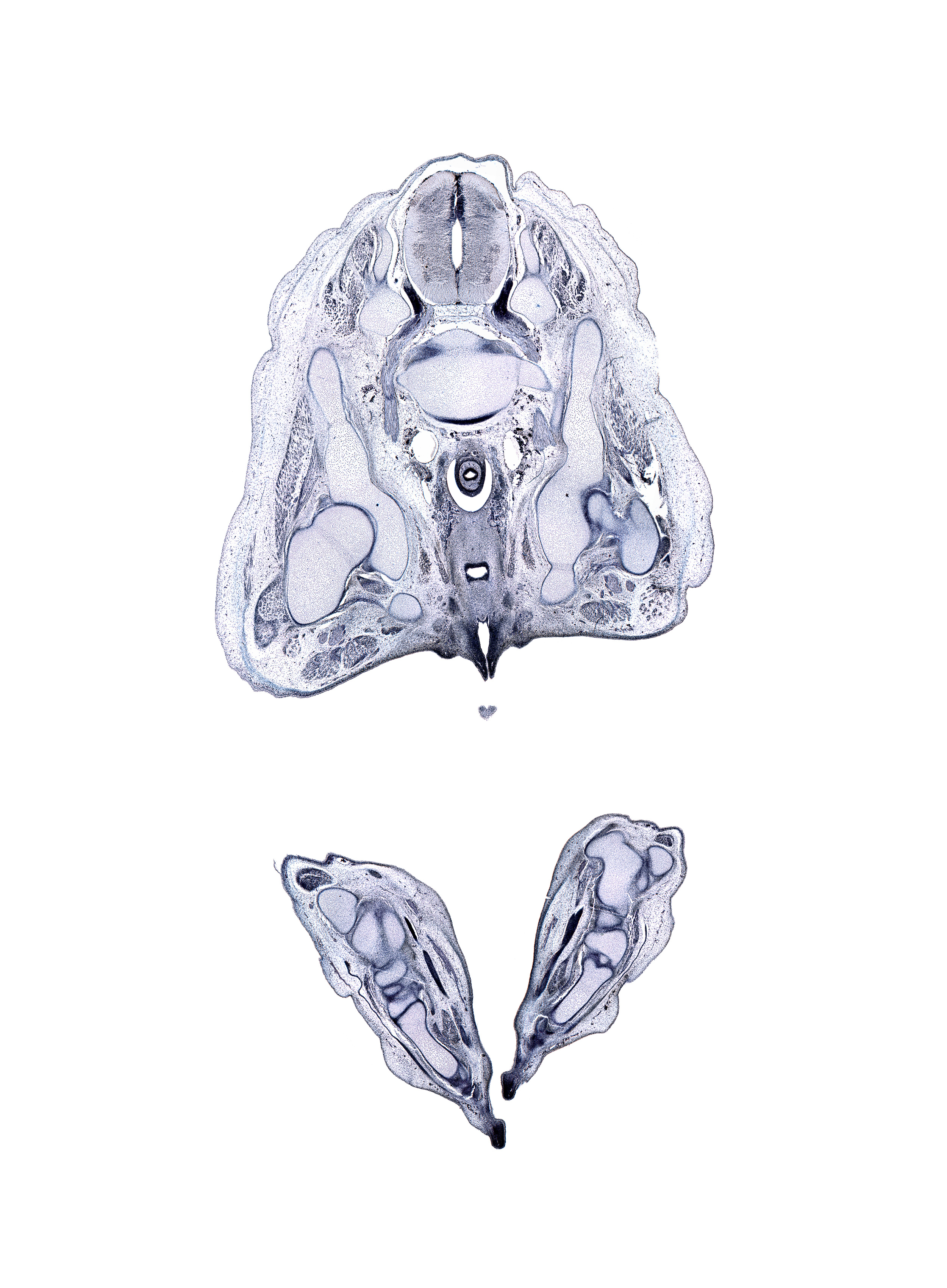 L-5 / S-1 intervertebral disc, L-5 spinal ganglion, calcaneal tendon, calcaneum, cuboid, cuneiform 3, edge of penis, extensor digitorum longus tendon, fibula, flexor digitorum longus tendon, greater trochanter of femur, ilium, lateral malleolus of fibula, levator ani muscle, lumbosacral trunk, metatarsal 2, metatarsal 3, obturator internus muscle, peritoneal cavity, rectum, sciatic nerve, talus, urethra, urethral groove