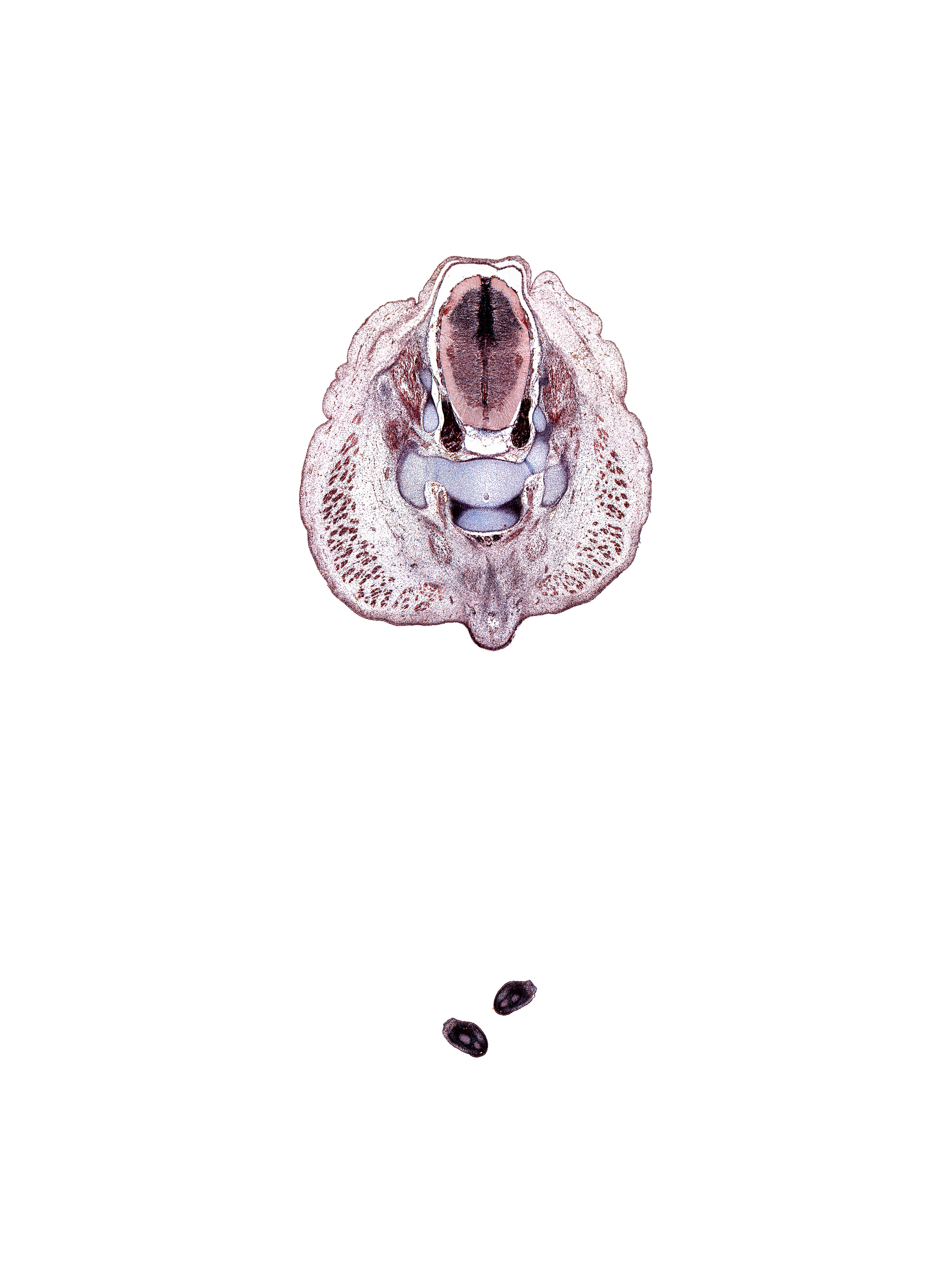 S-2 spinal ganglion, S-3 / S-4 intervertebral region, S-3 spinal ganglion, caudal eminence, centrum of S-3 vertebra, coccygeus muscle, digit 5 (foot), gluteus maximus muscle, median sacral artery, neural arch, notochord, sympathetic trunk