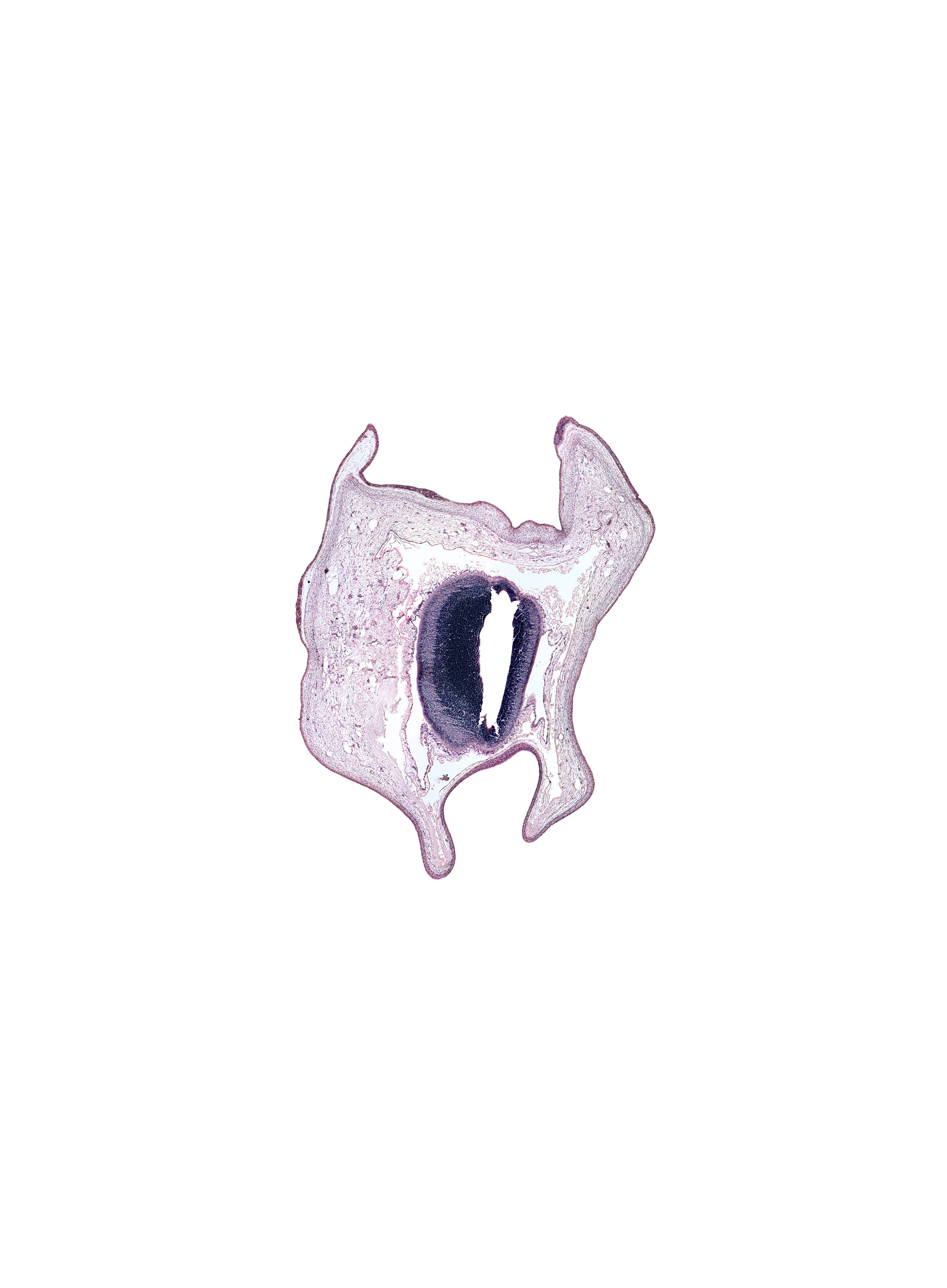 alar plate of mesencephalon, artifact fracture(s), cerebral aqueduct (mesocoele), head mesenchyme, roof plate