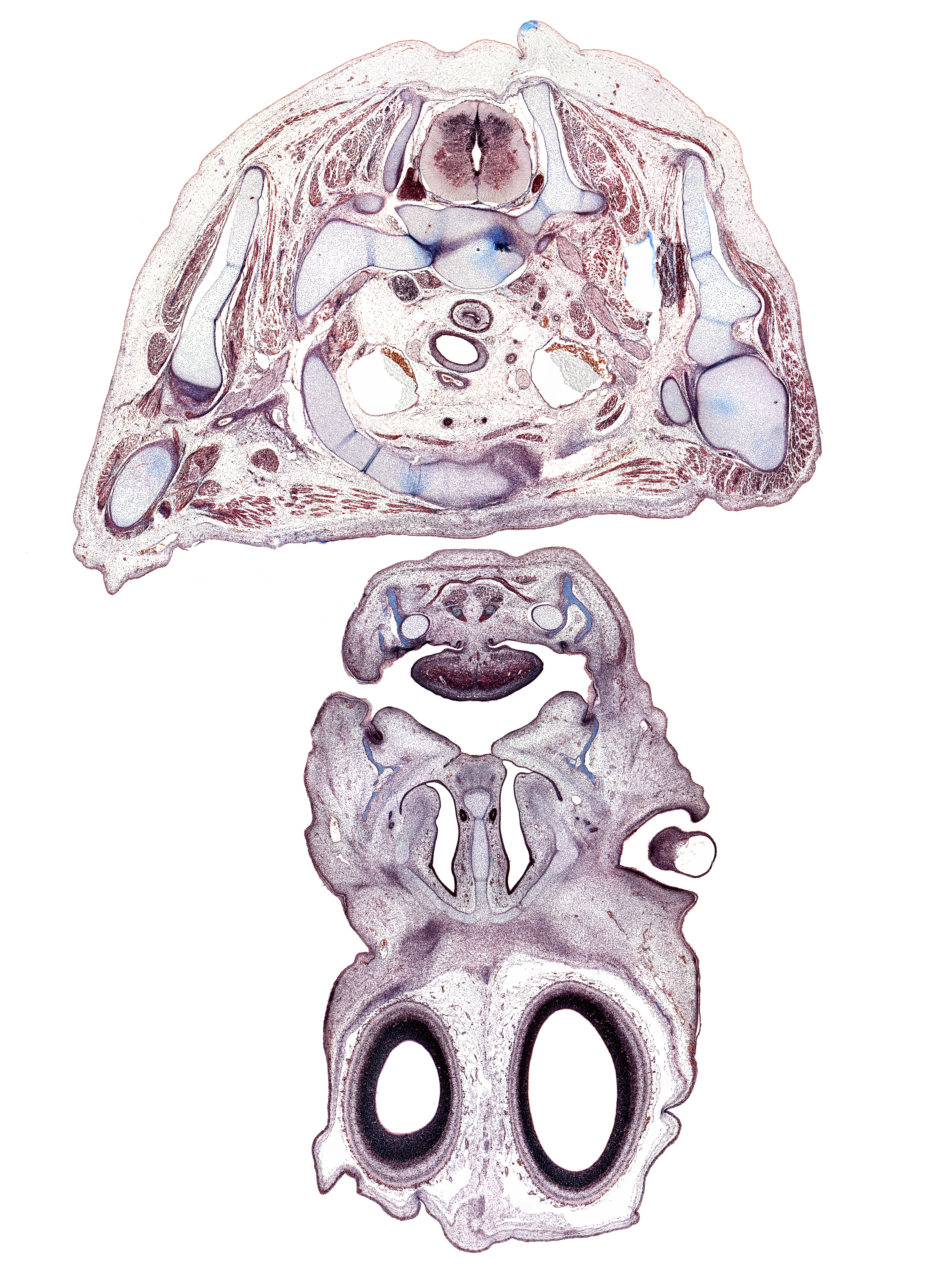 T-1 spinal ganglion, axillary artery, body of tongue, brachiocephalic artery, buccal region, central canal, coracobrachialis muscle, crista galli, deltoid muscle, dorsal horn of grey matter, esophagus, eyeball, falx cerebri region, glenohumeral joint, head of humerus, internal jugular vein, interorbital ligament, left common carotid artery, long head of triceps brachii muscle, lower eyelid, mandible, maxilla, spine of scapula, subarachnoid space, teres minor muscle, thymus gland, tooth bud(s), trachea, upper eyelid, ventral horn of grey matter, vomeronasal organ
