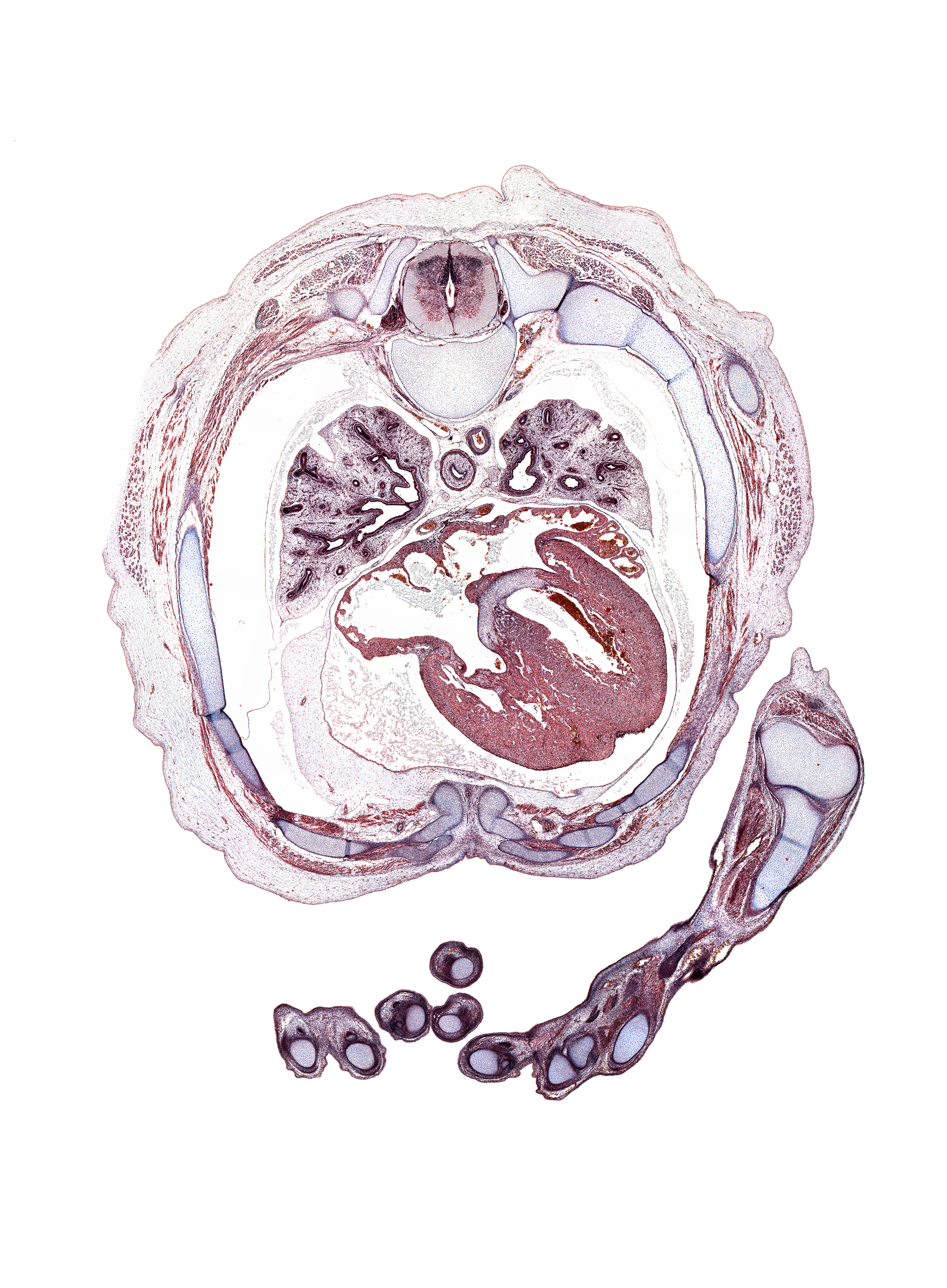 T-5 spinal ganglion, aorta, artifact(s), azygos vein, external intercostal muscle(s), flexor digitorum tendons, hypothenar eminence, inferior tertiary bronchus, innermost intercostal muscle(s), interdigital notch, intermediate phalynx of digit 3 (middle finger), internal intercostal muscle(s), lateral epicondyle of humerus, lateral tertiary bronchus, left atrium, left digit 2 (index finger), medial tertiary bronchus, membranous part of interventricular septum, metacarpophalangeal joint of digit 4 (ring finger), pericardial sac, rib 5, rib 6, rib 7, rib 8, right atrium, secondary interatrial foramen (foramen secundum), sternocostal muscle, trapezius muscle, upper lobe of left lung, volar surface of right digit 3 (middle finger)